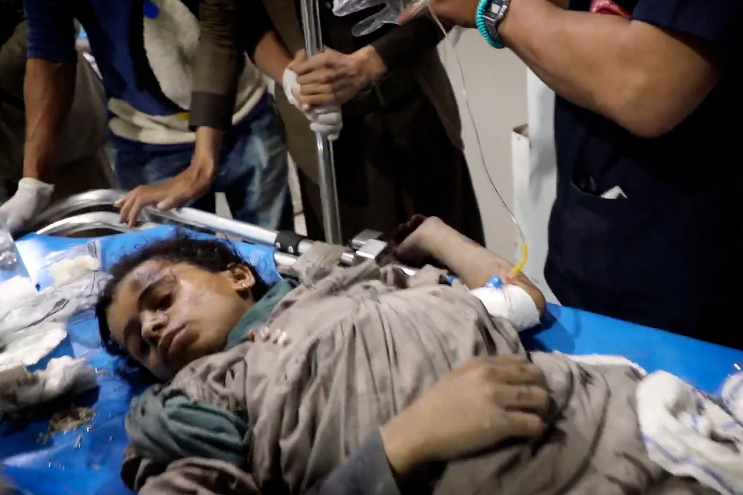 Foto tomada de video, difundido por la Oficina de Prensa Ansar Allah via el canal de televisión Al Masirah, que muestra a un niño herido en un hospital en hospital en Saada, Yemen, el 15 de marzo del 2025 tras ataques aéreos en el país. (Al Masirah TV via AP)