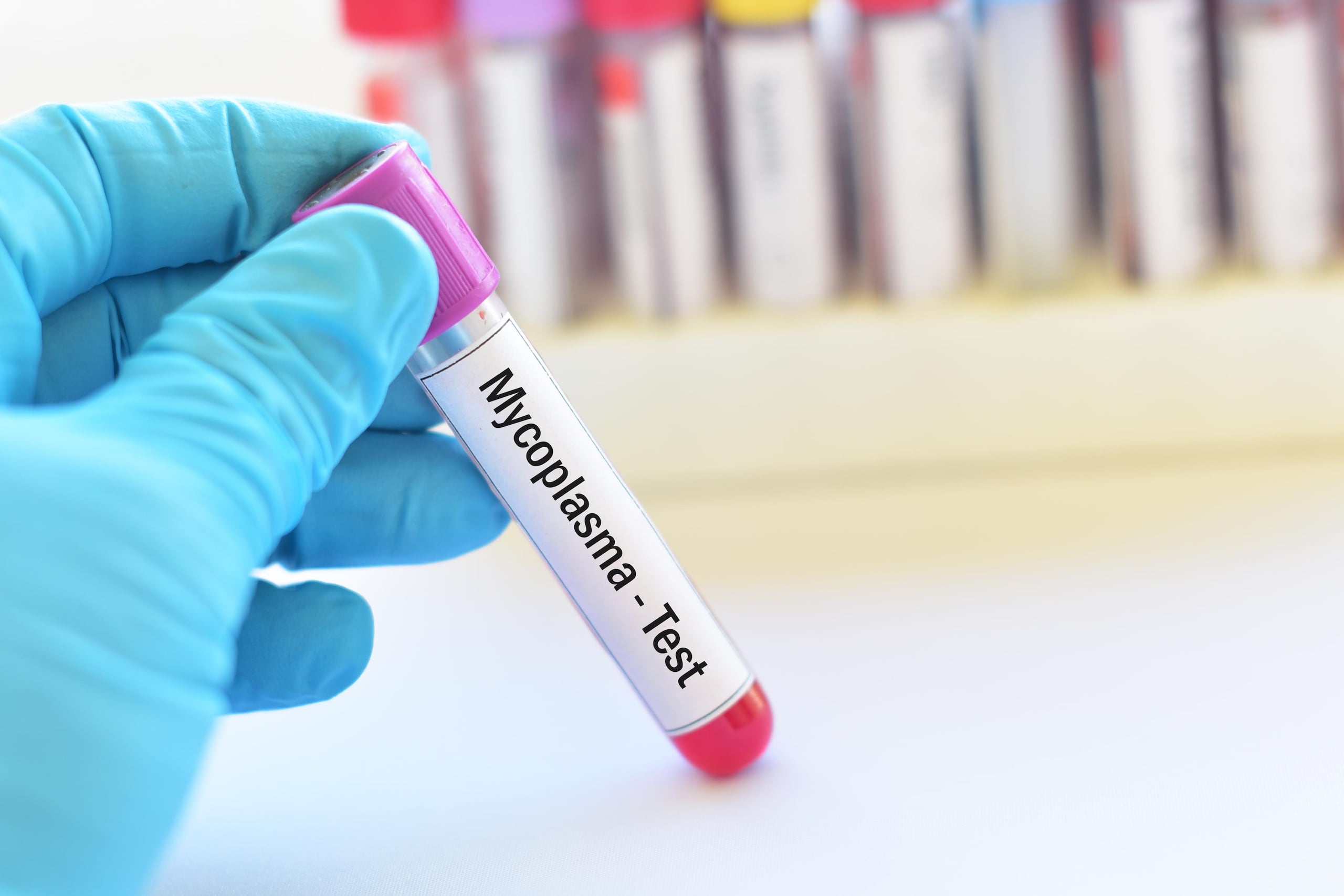 Tos seca, dolor de pecho, escalofríos, sudoración excesiva, fiebre, dolor de cabeza y dolor de garganta son algunos síntomas de neumonía por micoplasma, los cuales suelen aparecer entre una y tres semanas después del contagio. (Shutterstock)