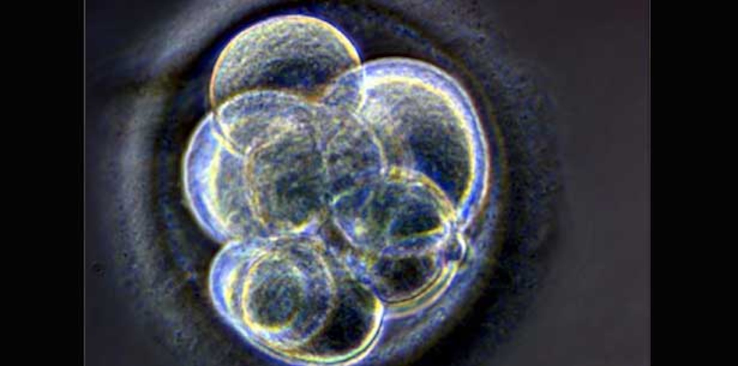 Normalmente las células madre en la médula ósea maduran y se desarrollan en tres tipos de células sanguíneas: las células rojas, las células blancas y las plaquetas. (Archivo)