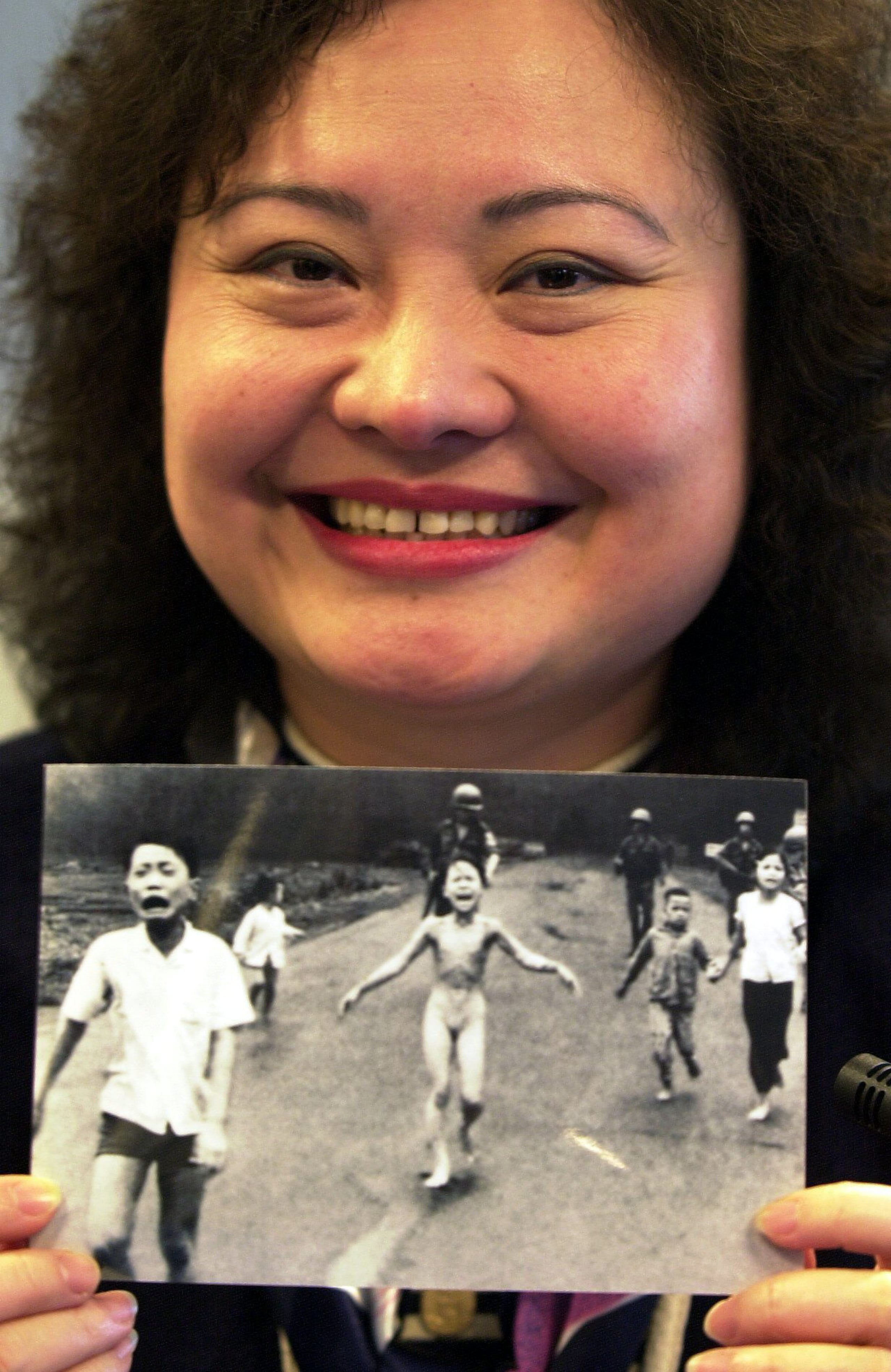 La niña que protagoniza la foto, Thi Kim Phúc, sobrevivió y se sometió a diversas operaciones y tratamientos a lo largo de su vida y actualmente es embajadora de la paz de la UNESCO.