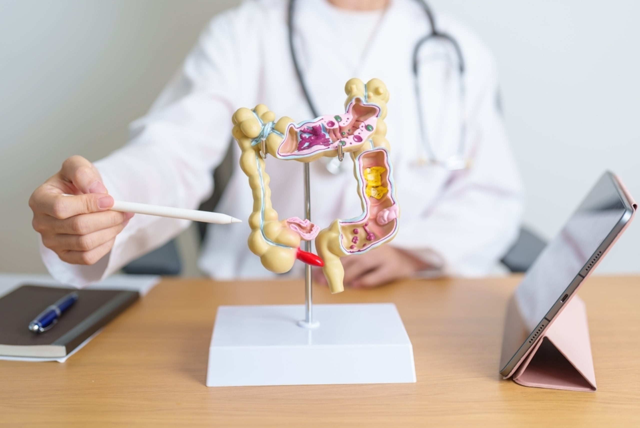 La observación de síntomas y la detección temprana del cáncer de colon son herramientas para evitar posibles complicaciones.