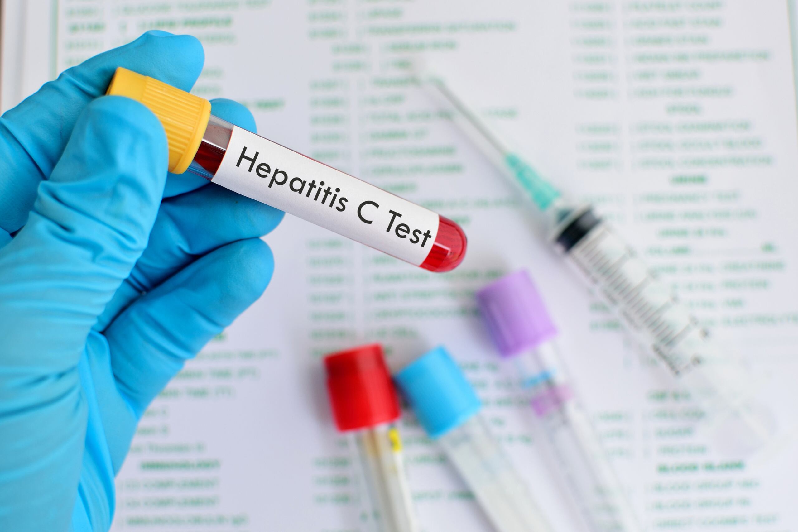 Hepatitis C.