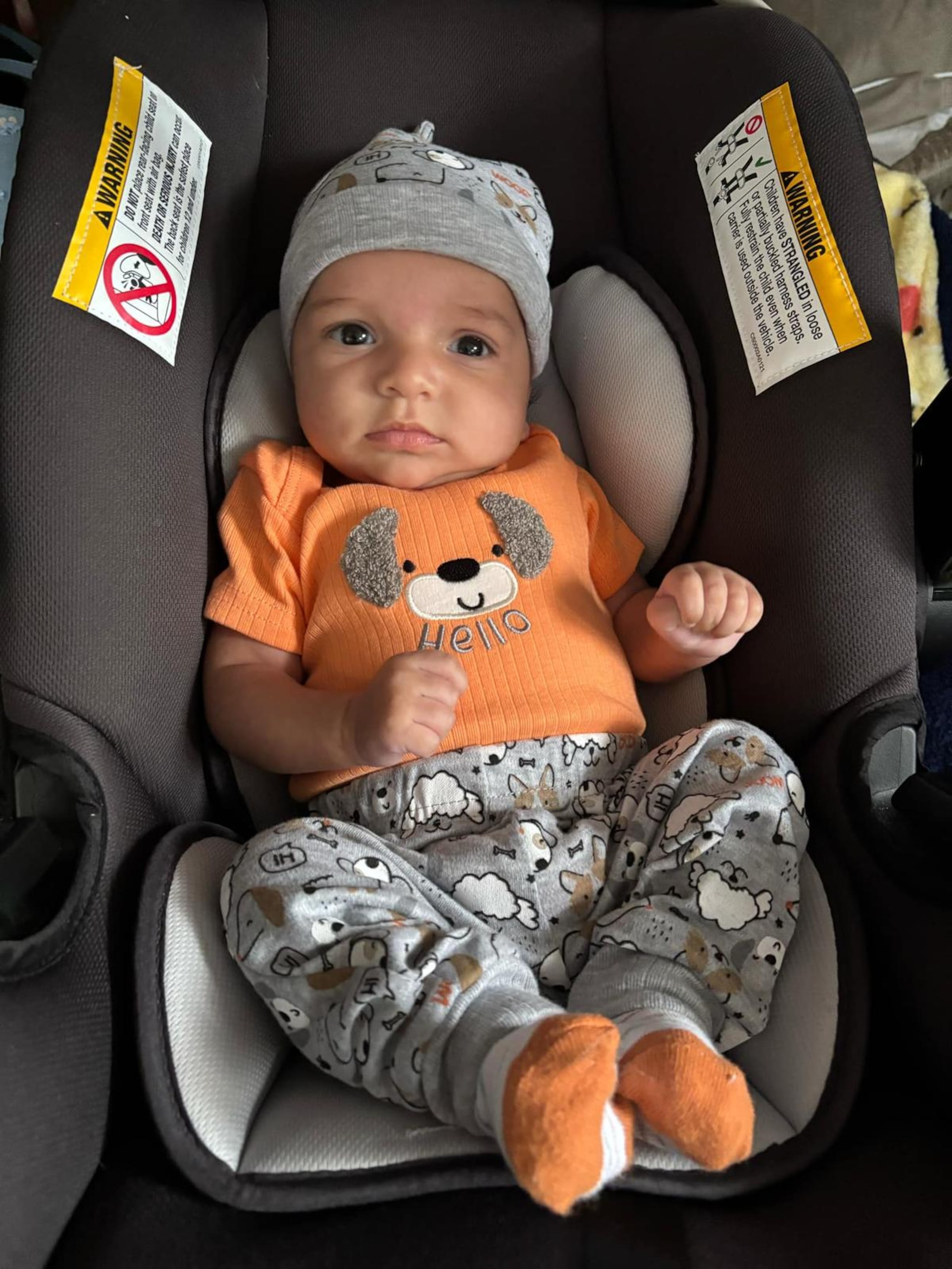 El pequeño Sebastián Martínez Santana padece de fibrosis quística.