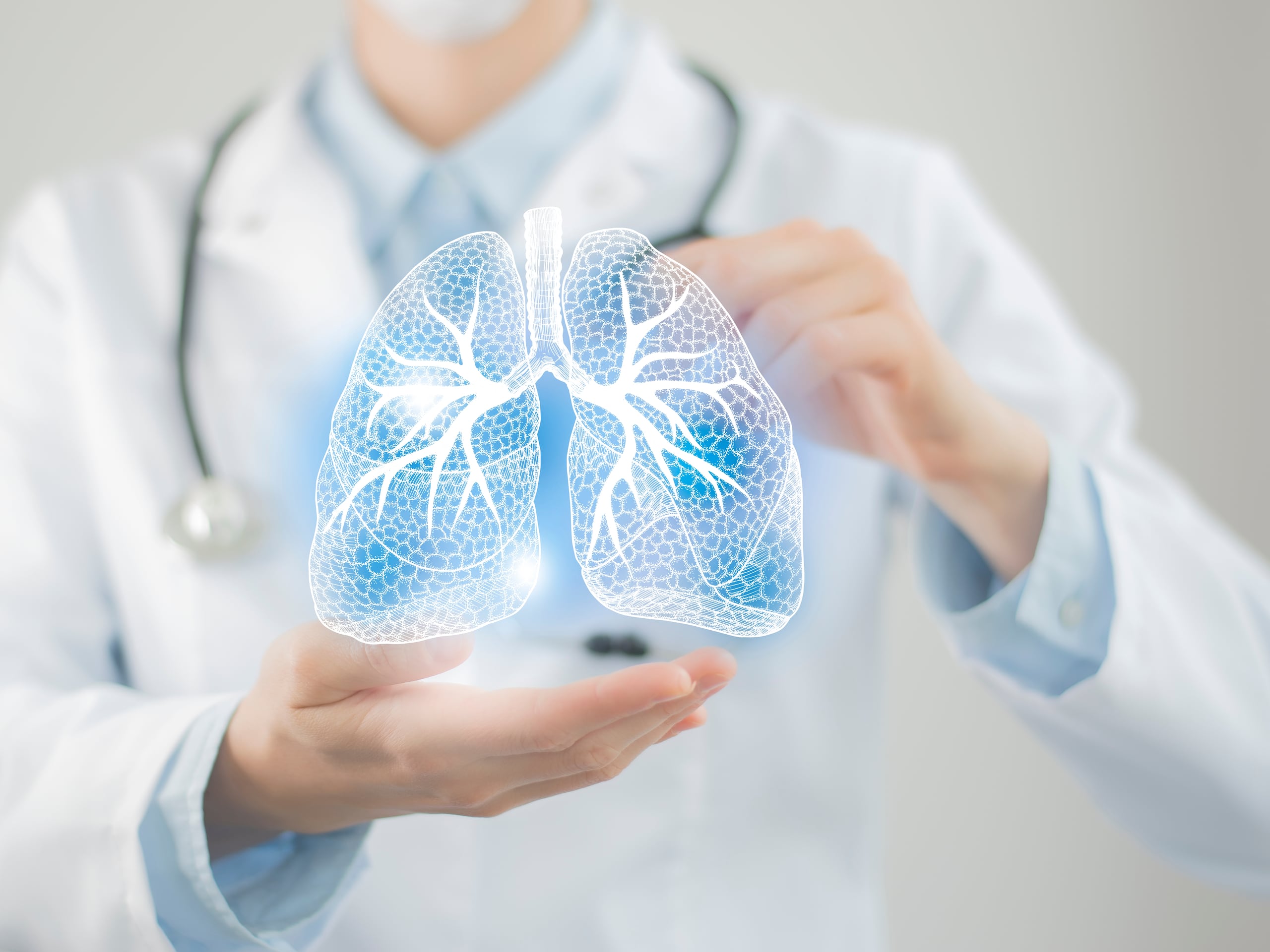 Hay varios tipos de cáncer de pulmón. El más común es el cáncer de pulmón de células no pequeñas, también llamado no microcítico, el cual representa un 85 % de todos los casos de cáncer pulmonar.