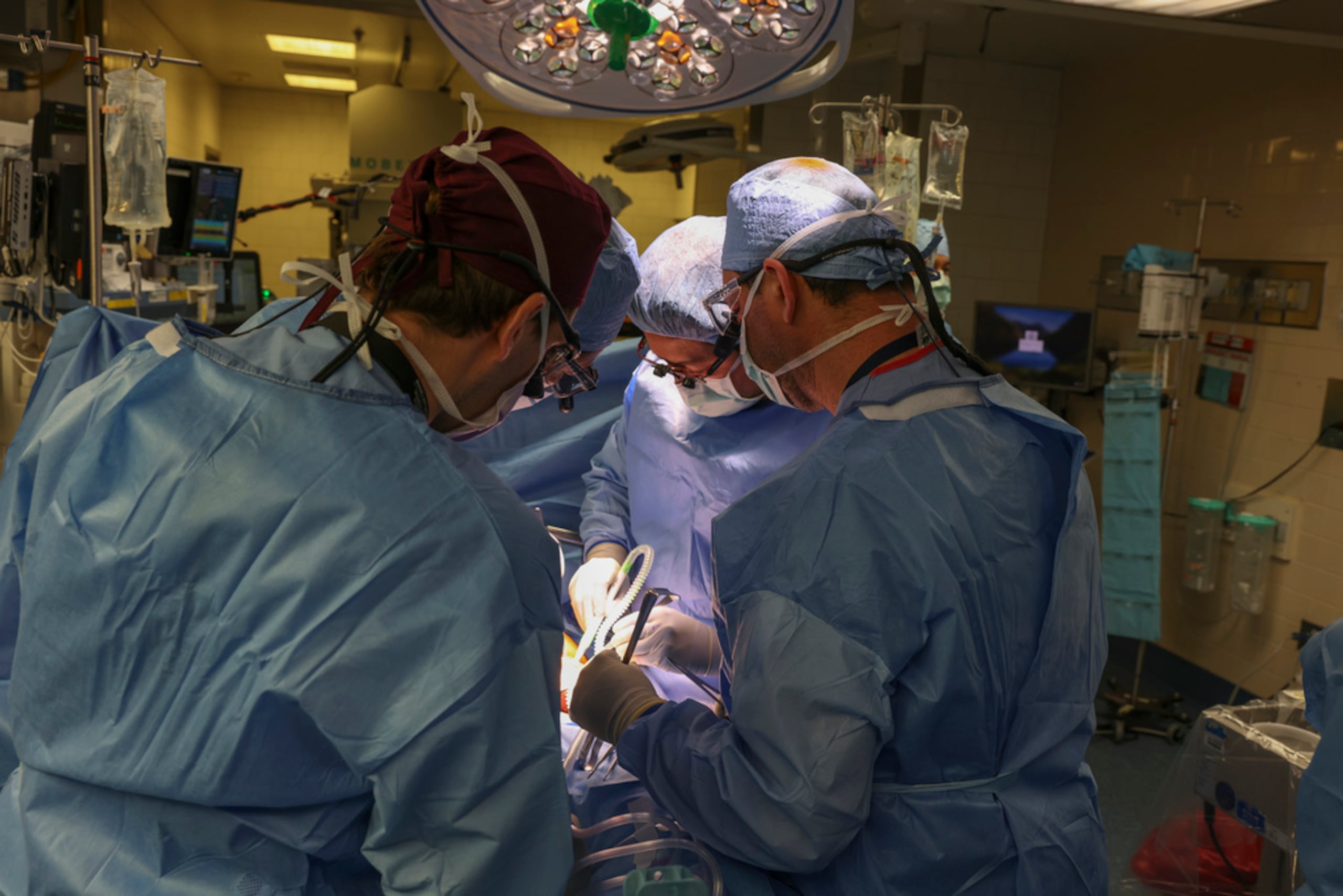 Cirujanos realizan el primer trasplante de riñón de cerdo genéticamente modificado a un ser humano vivo en el Hospital General de Massachusetts el 16 de marzo de 2024.