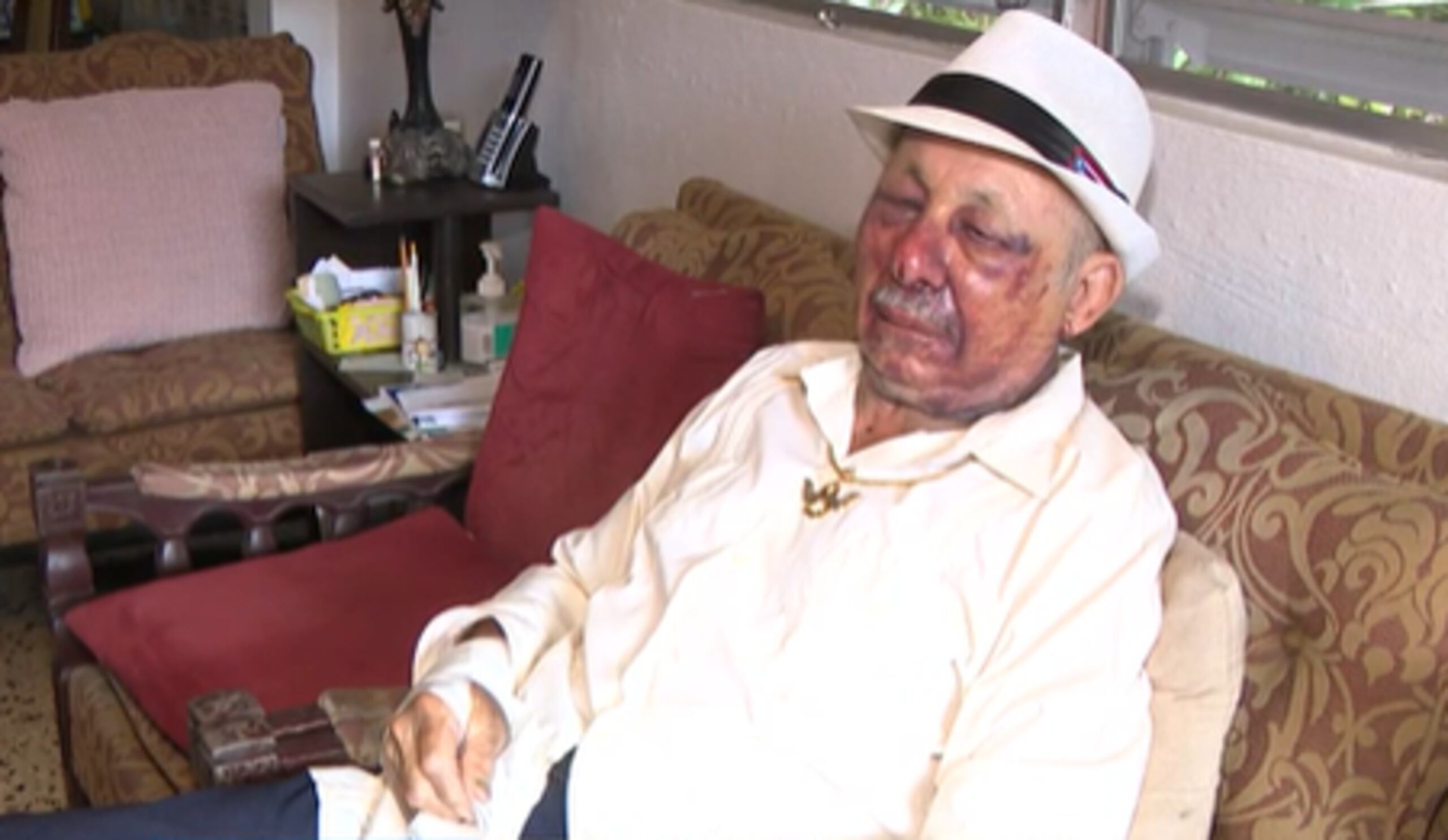 Don William Torres se recuperó de las lesiones.