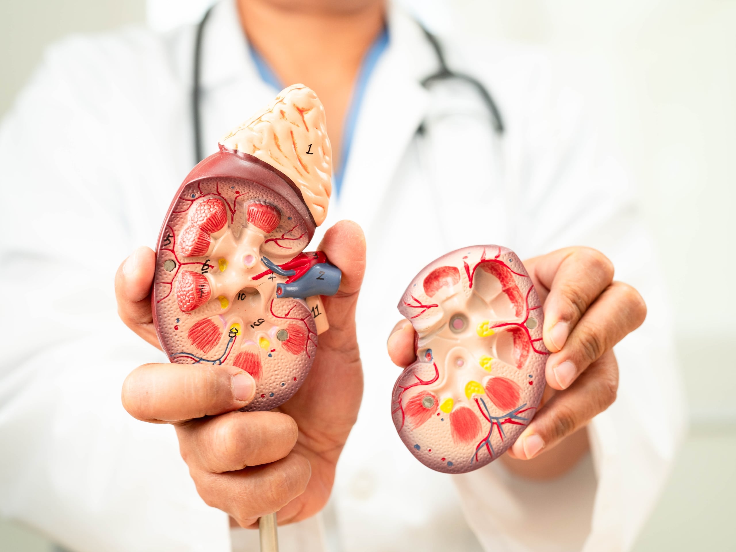 Se estima que 1 de cada 3 adultos con diabetes, probablemente, padecerá de enfermedad renal crónica.