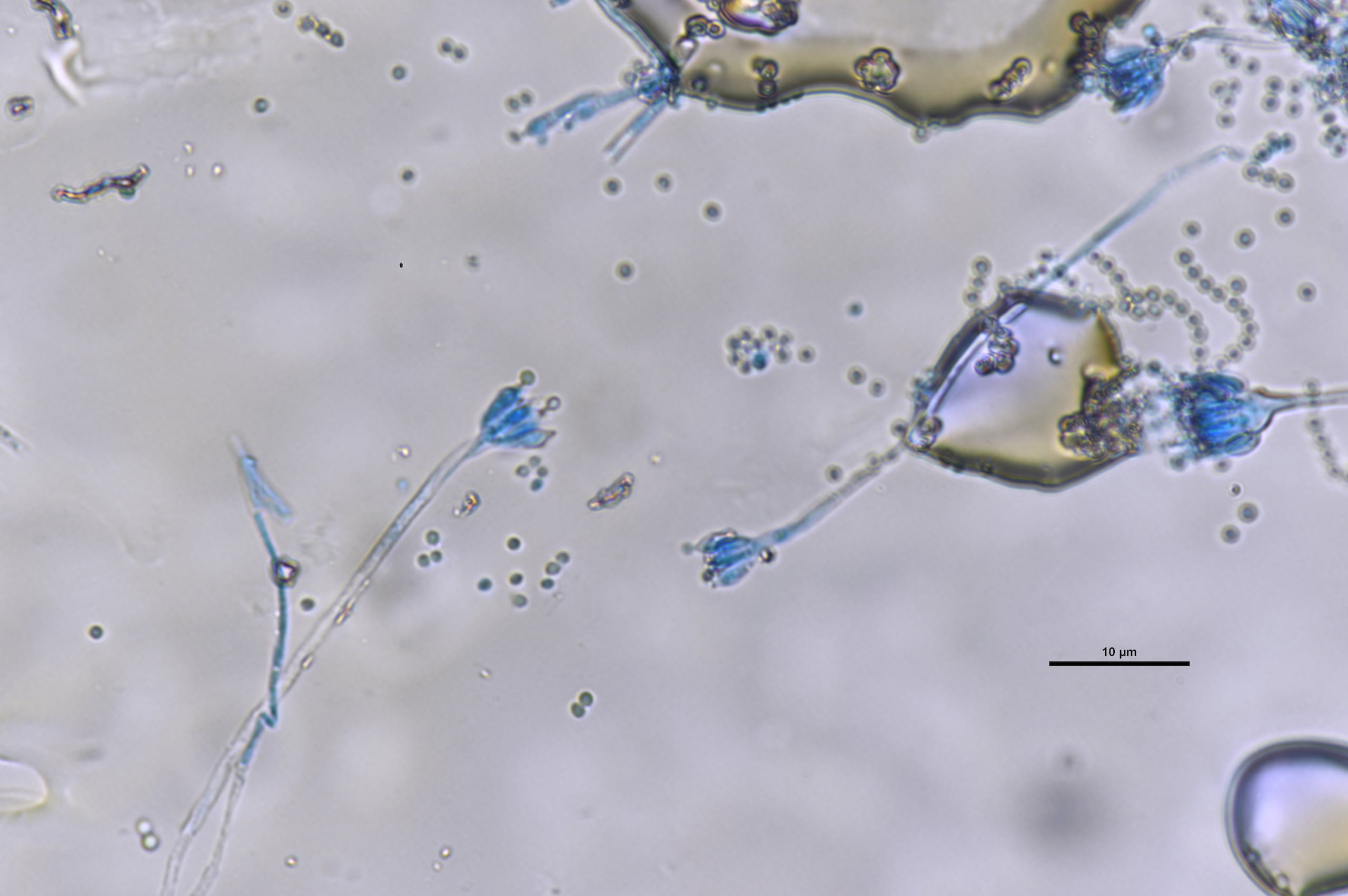 Colonias del hongo Aspergillus.