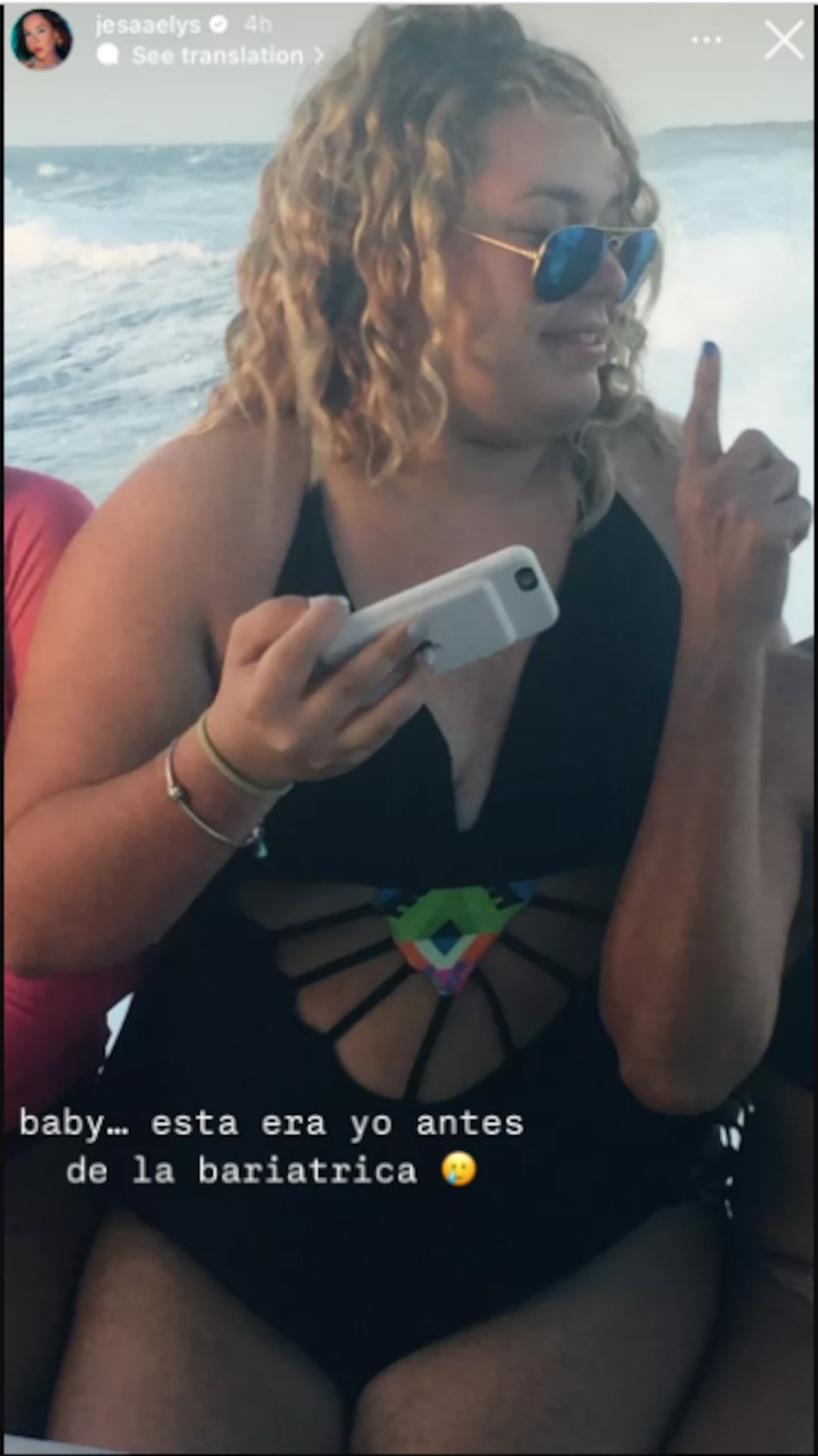 La "influencer" compartió un retrato anterior al proceso quirúgico que se sometió en 2016.