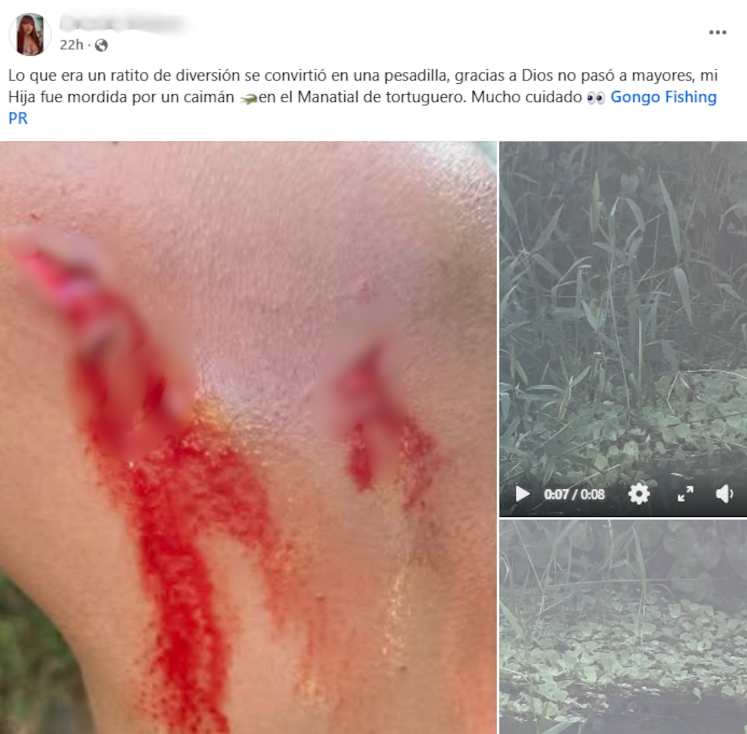 Imagen compartida por redes sociales sobre supuesto ataque de caimán en Vega Baja el pasado 3 de mayo de 2026.