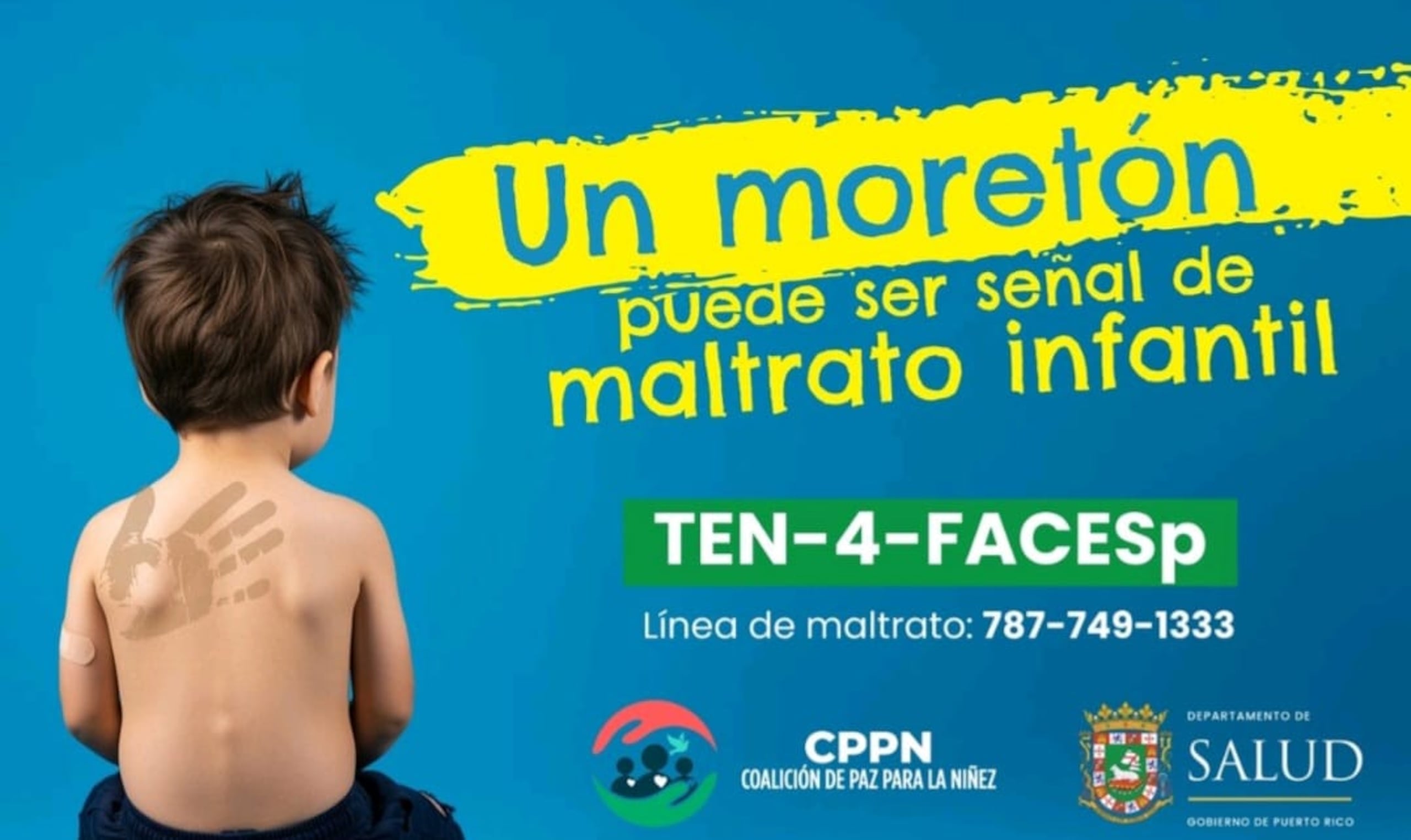 La regla clínica TEN-4-FACESp, está reconocida internacionalmente como un estándar efectivo en la identificación de posibles señales de abuso físico en menores de edad.