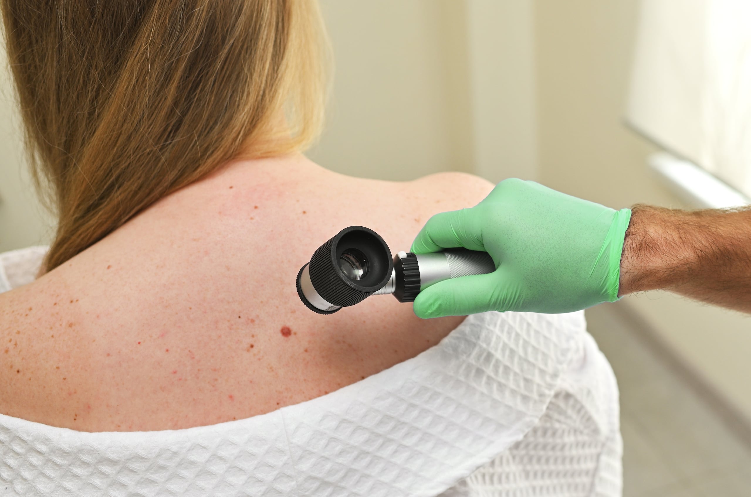 Además del autoexamen, toda persona debería considerar una evaluación dermatológica periódica.