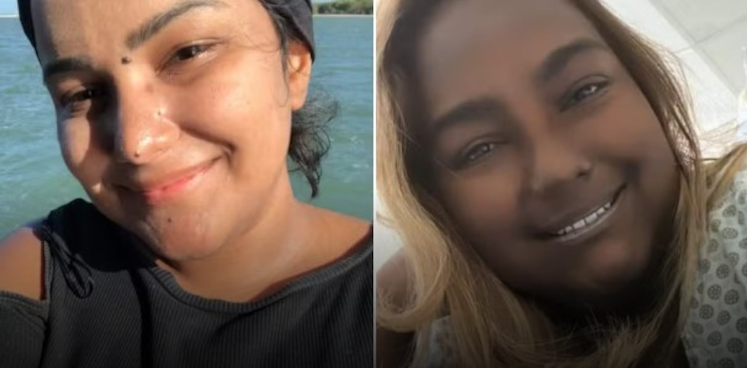 La vida de Sabrina Gomes, de 24 años, cambió por completo cuando le diagnosticaron síndrome de Cushing y timoma.