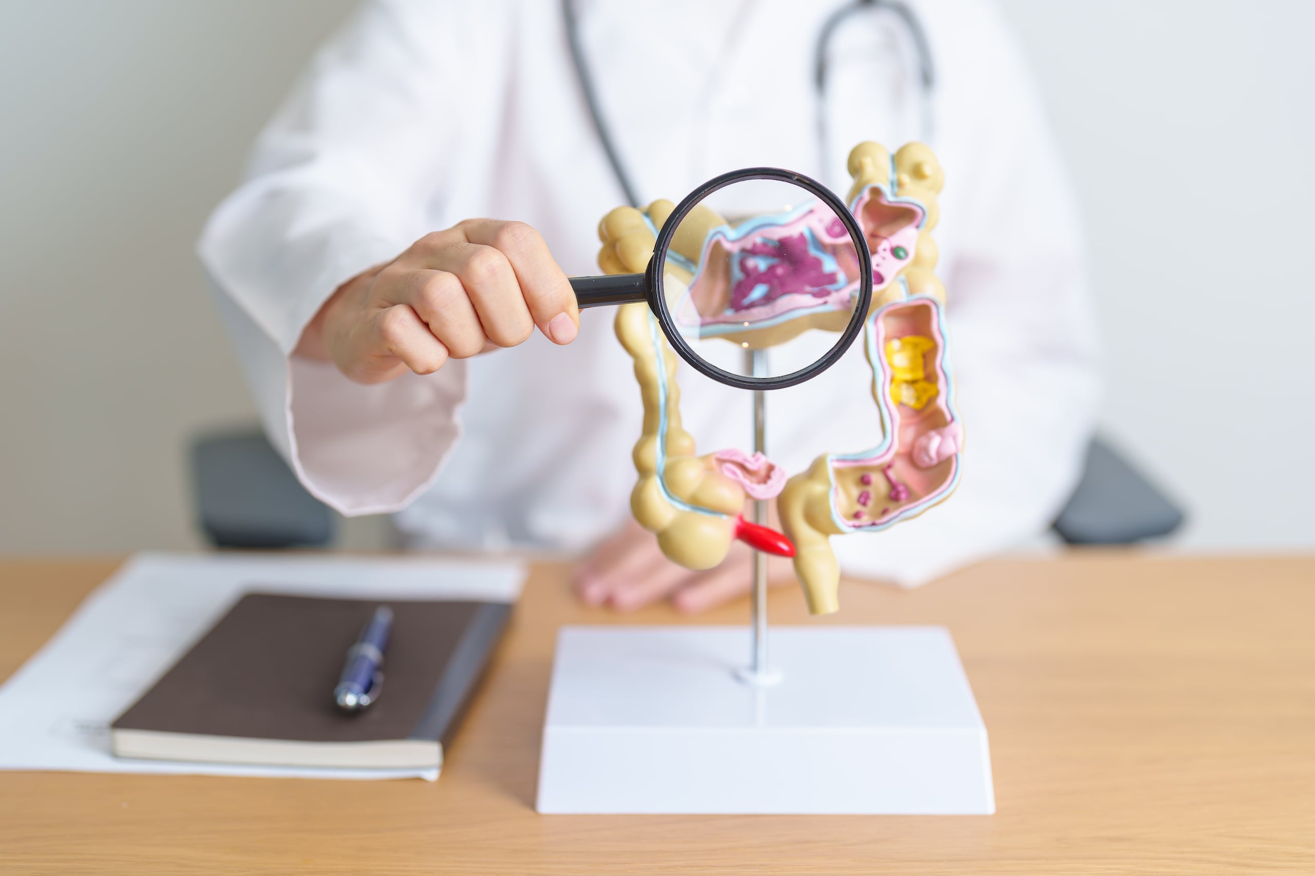 Si se encuentran los tumores de cáncer colorrectal en una etapa temprana, el paciente puede tener una buena sobrevida.