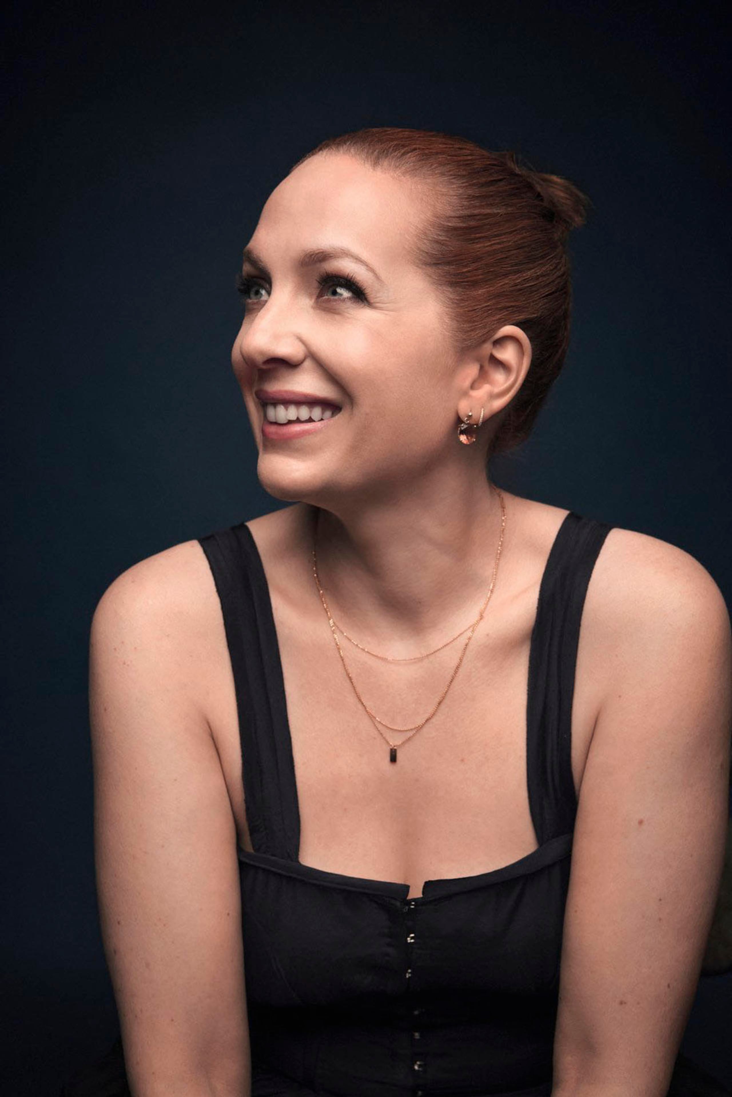 Katherine Parkinson hará de Molly Weasley, el personaje que en el cine interpretó Julie Walters.