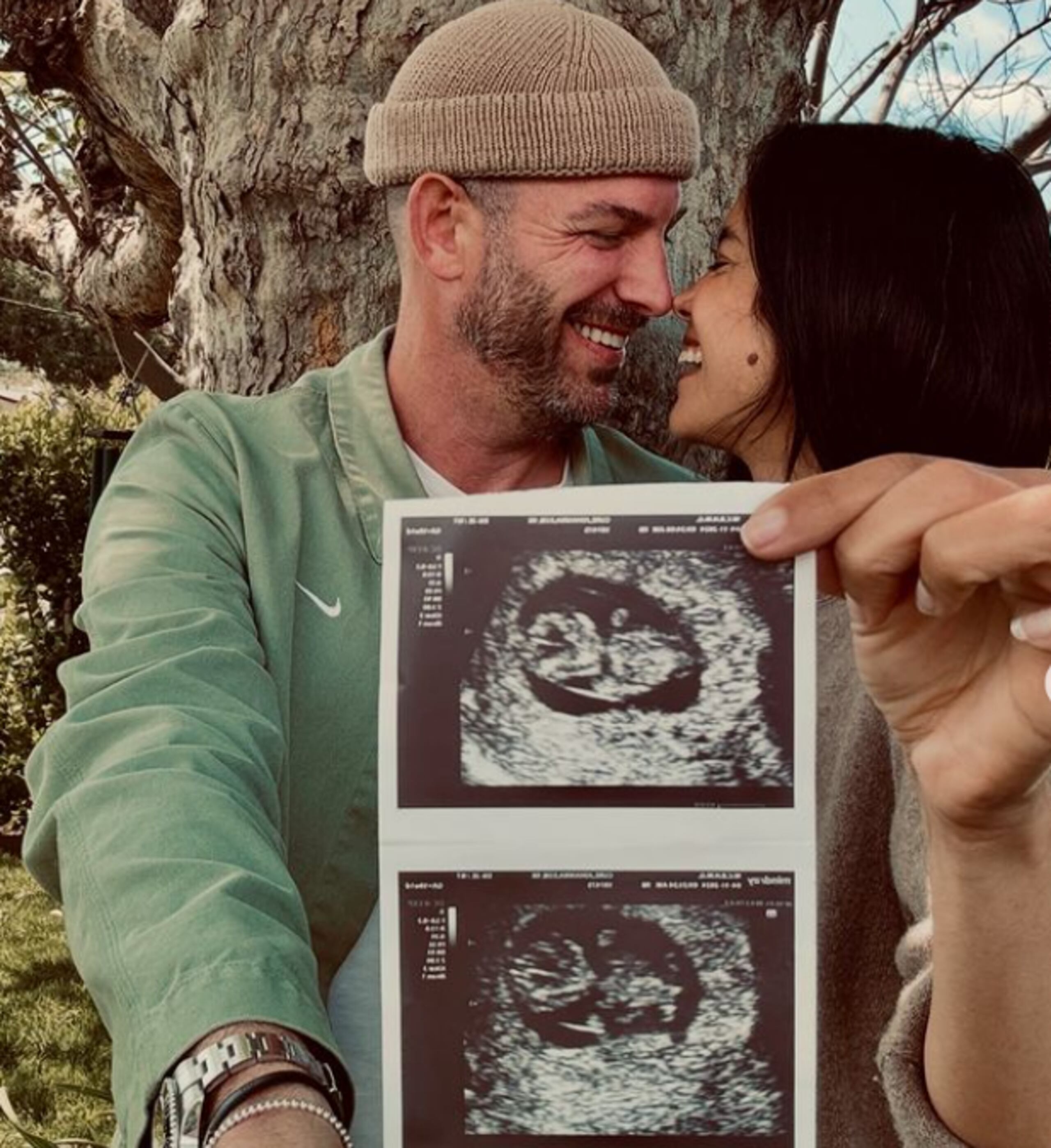 La actriz Johanna Curé y su esposo posan con uno de sus primeros ultrasonidos