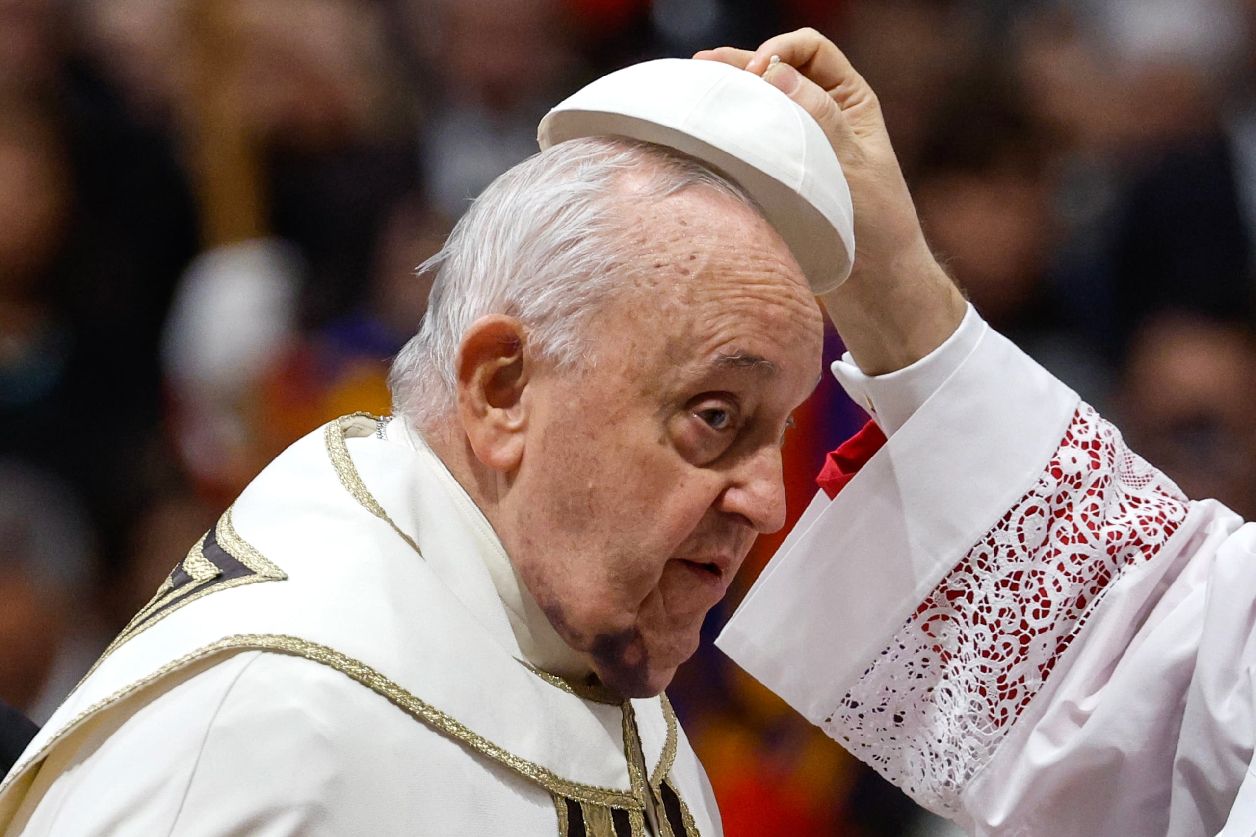 El papa Francisco este sábado con un hematoma en el rostro. EFE/EPA/FABIO FRUSTACI