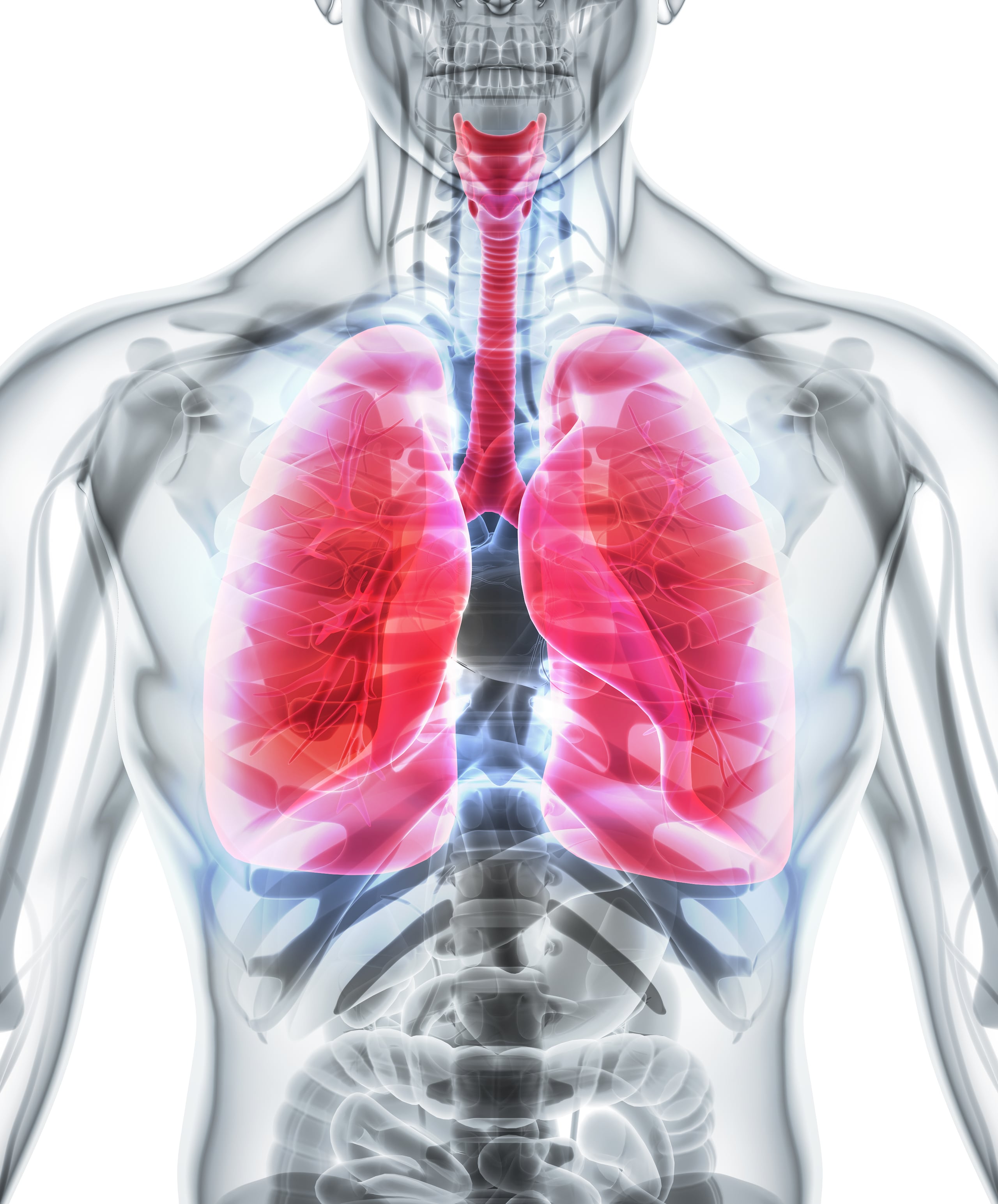 El cáncer de pulmón es una de las principales causas de muerte por cáncer en todo el mundo.