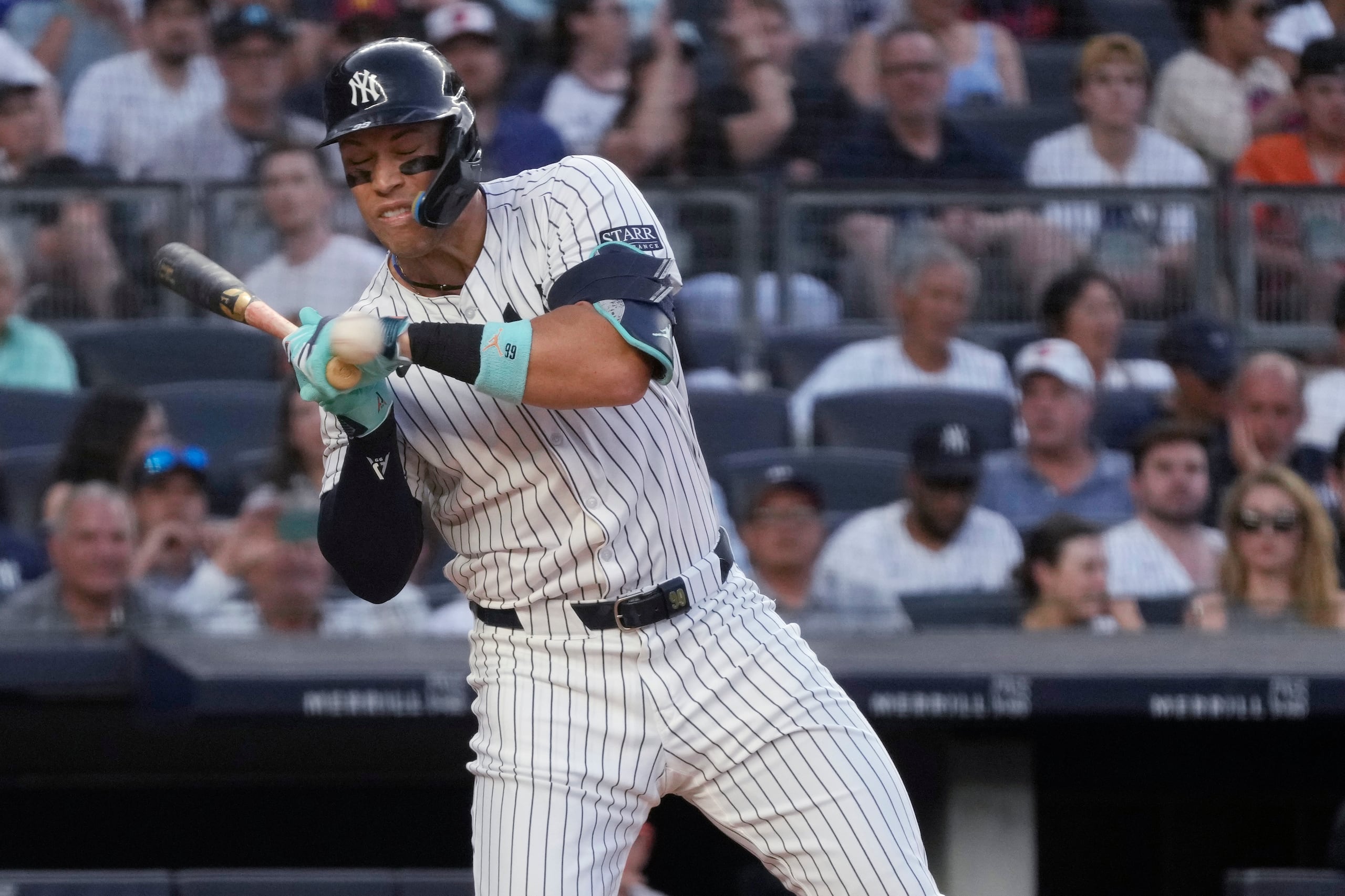 Aaron Judge, de los Yankees de Nueva York, recibe un pelotazo del venezolano Albert Suárez.