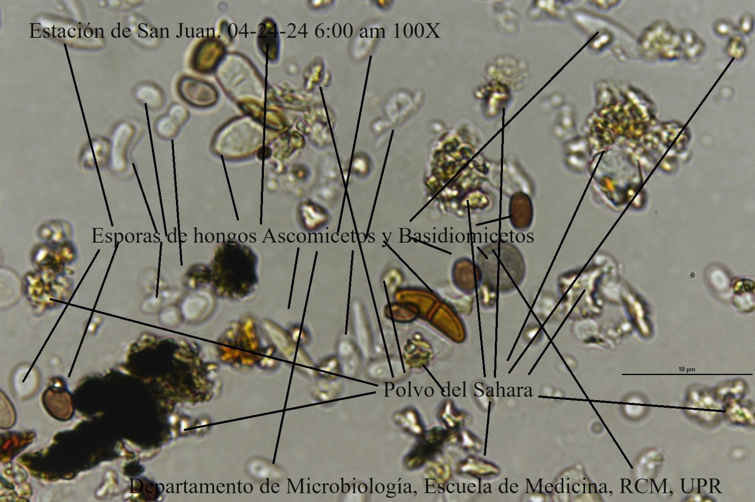 Laminilla que muestra la presencia de polvo y hongos en el ambiente en la mañana del 24 de abril.