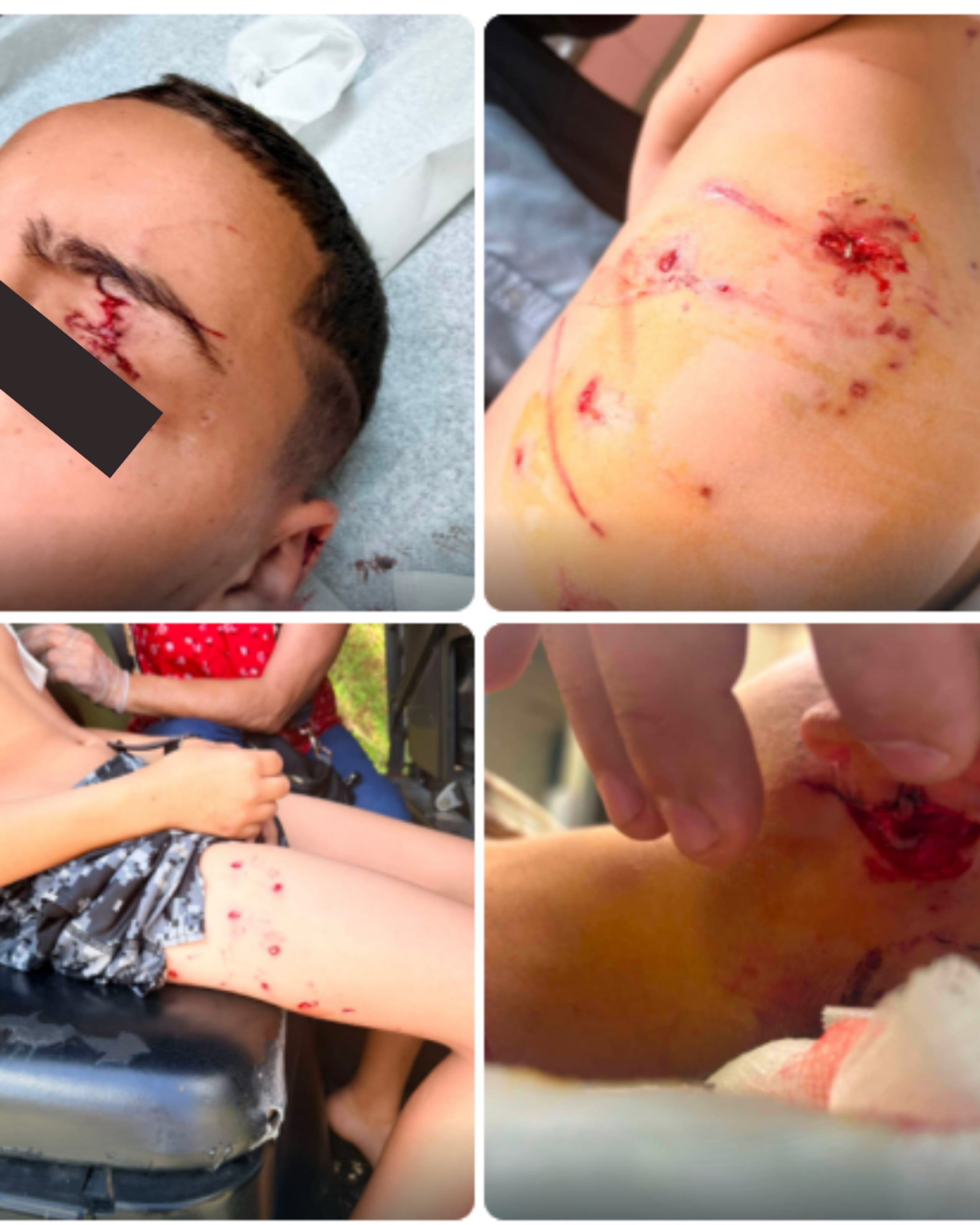 El menor fue atacado por siete perros en los predios de su escuela en San Sebastián.