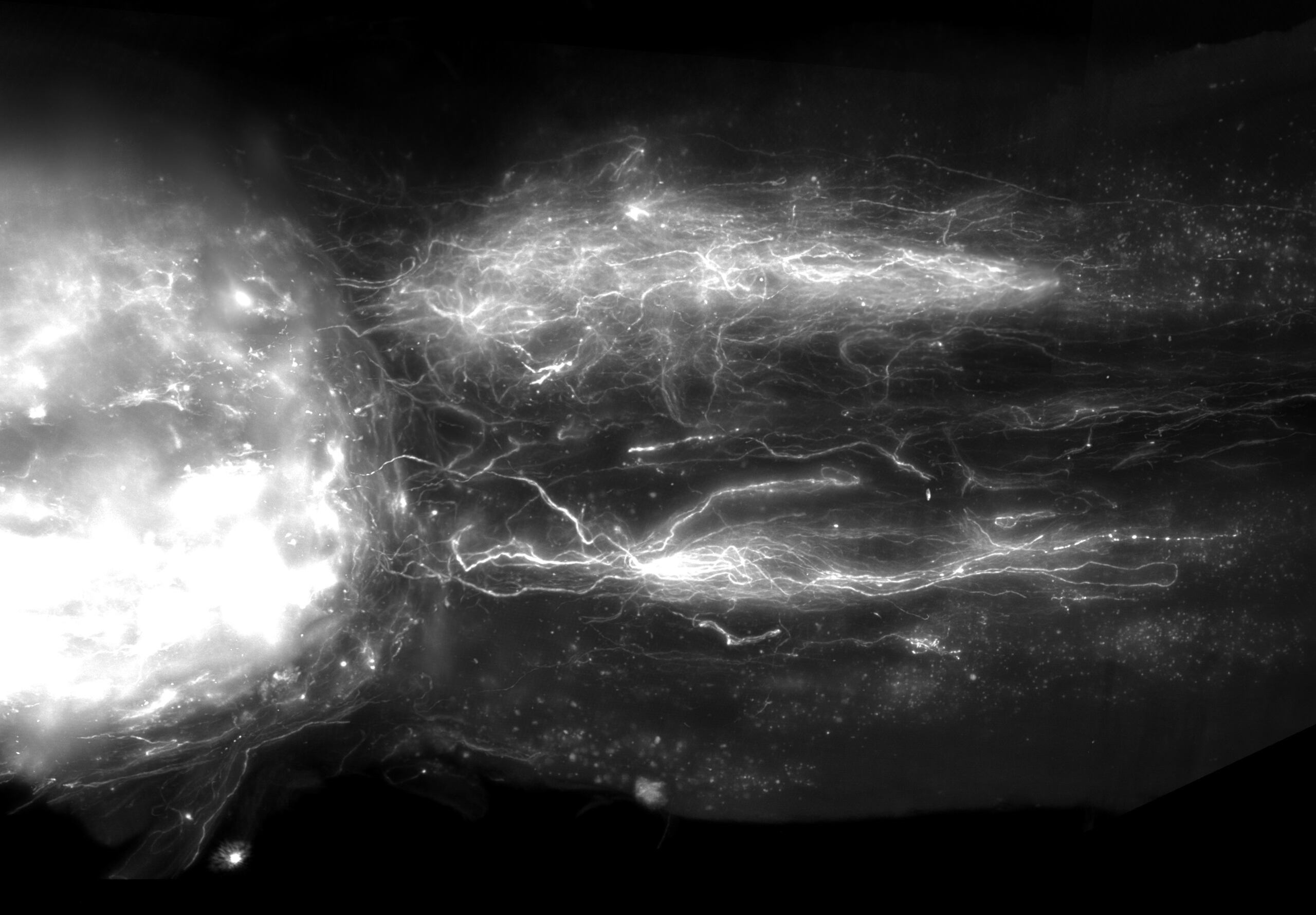 Visualización de las proyecciones en regeneración de la médula espinal torácica inferior que se proyectan a los centros de ejecución de la marcha. Crédito: EPFL /.Neurorestore