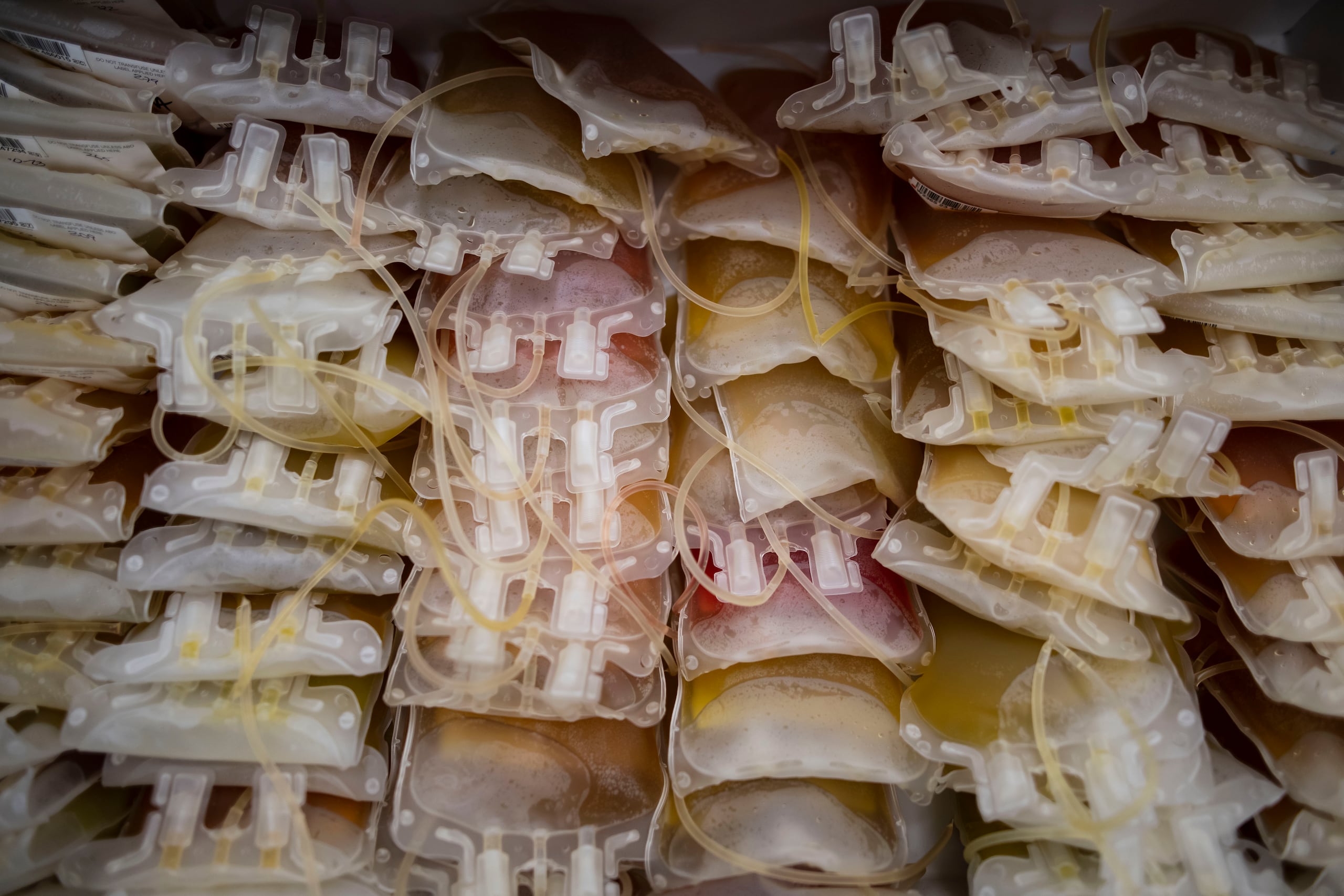 Los donantes de plaquetas deben alimentarse bien y tomar agua, y deben pesar más de 130 libras.