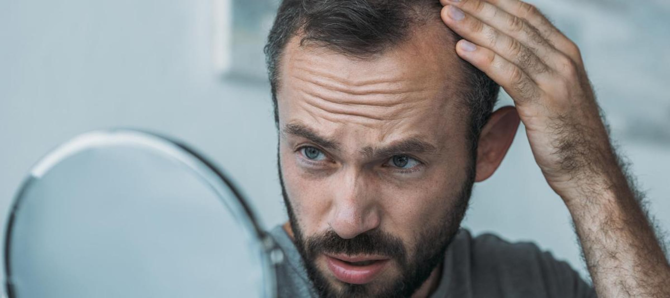 Algunos hombres sufren pérdida del cabello.