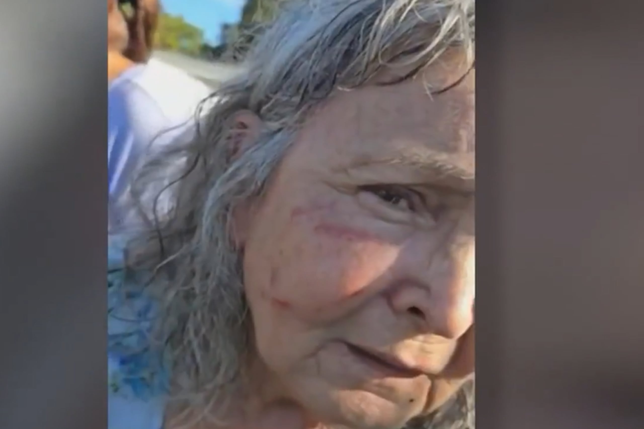 Mujer golpeada en Florida por su vecino