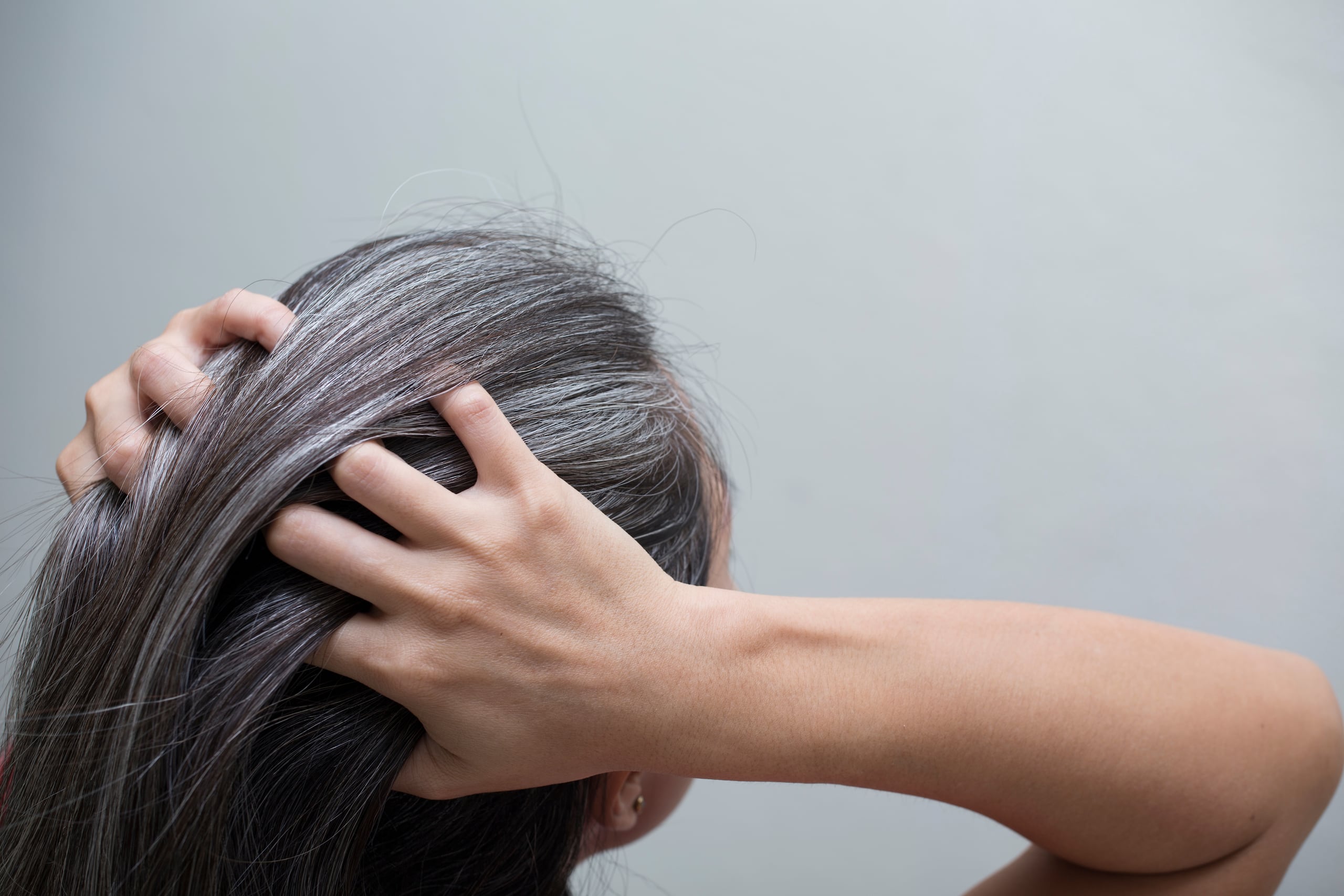 Las canas se deben a la falta de melanina o la baja pigmentación en el cuero cabelludo.