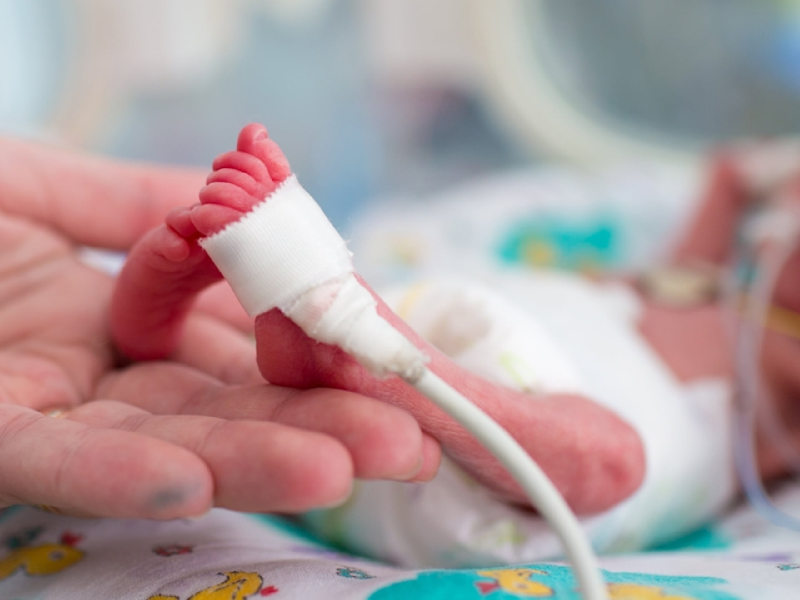 La tasa de nacimientos prematuros en Puerto Rico es de 11.4%.