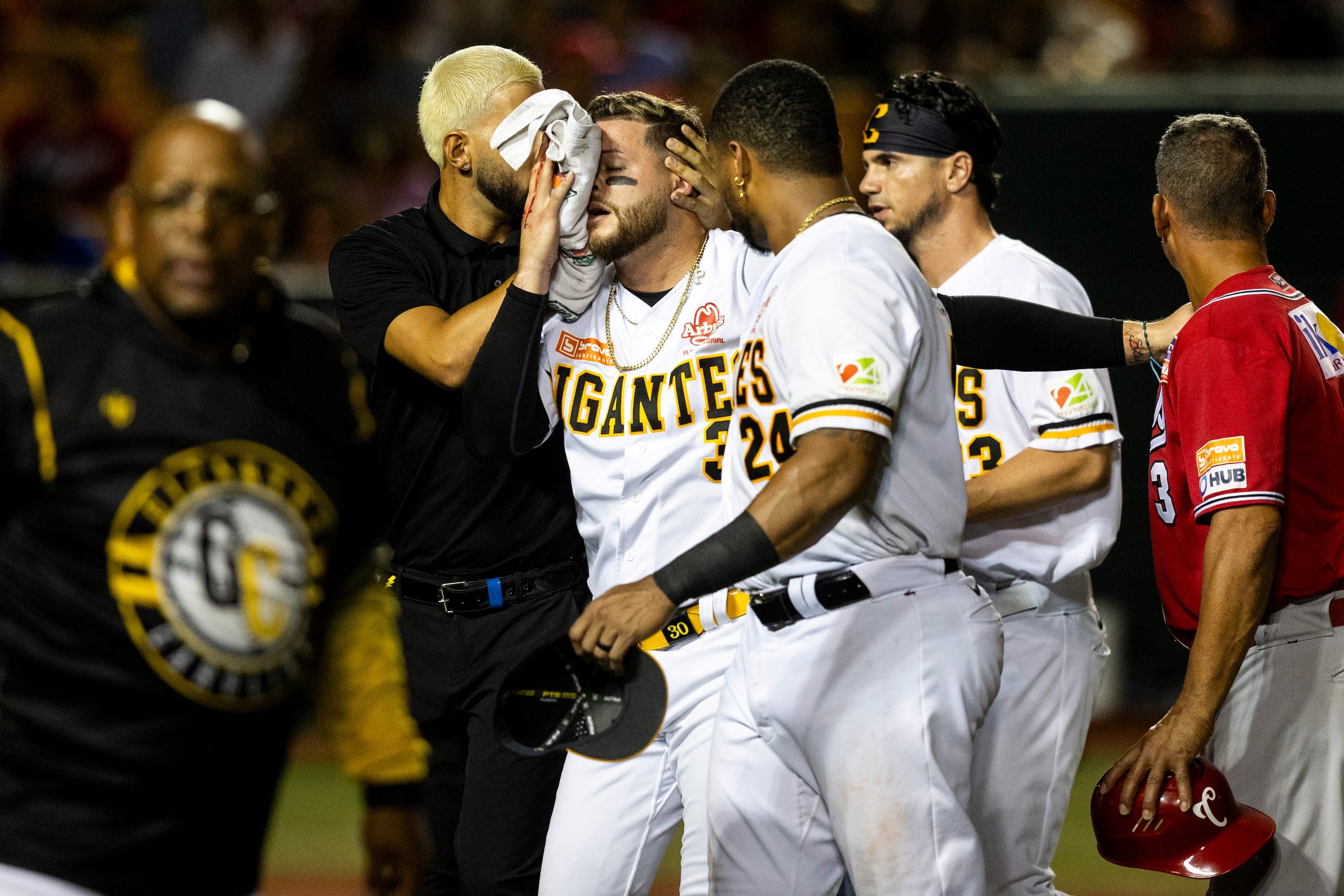 Alexis Pantoja sale del terreno tras recibir un pelotazo en su rostro.