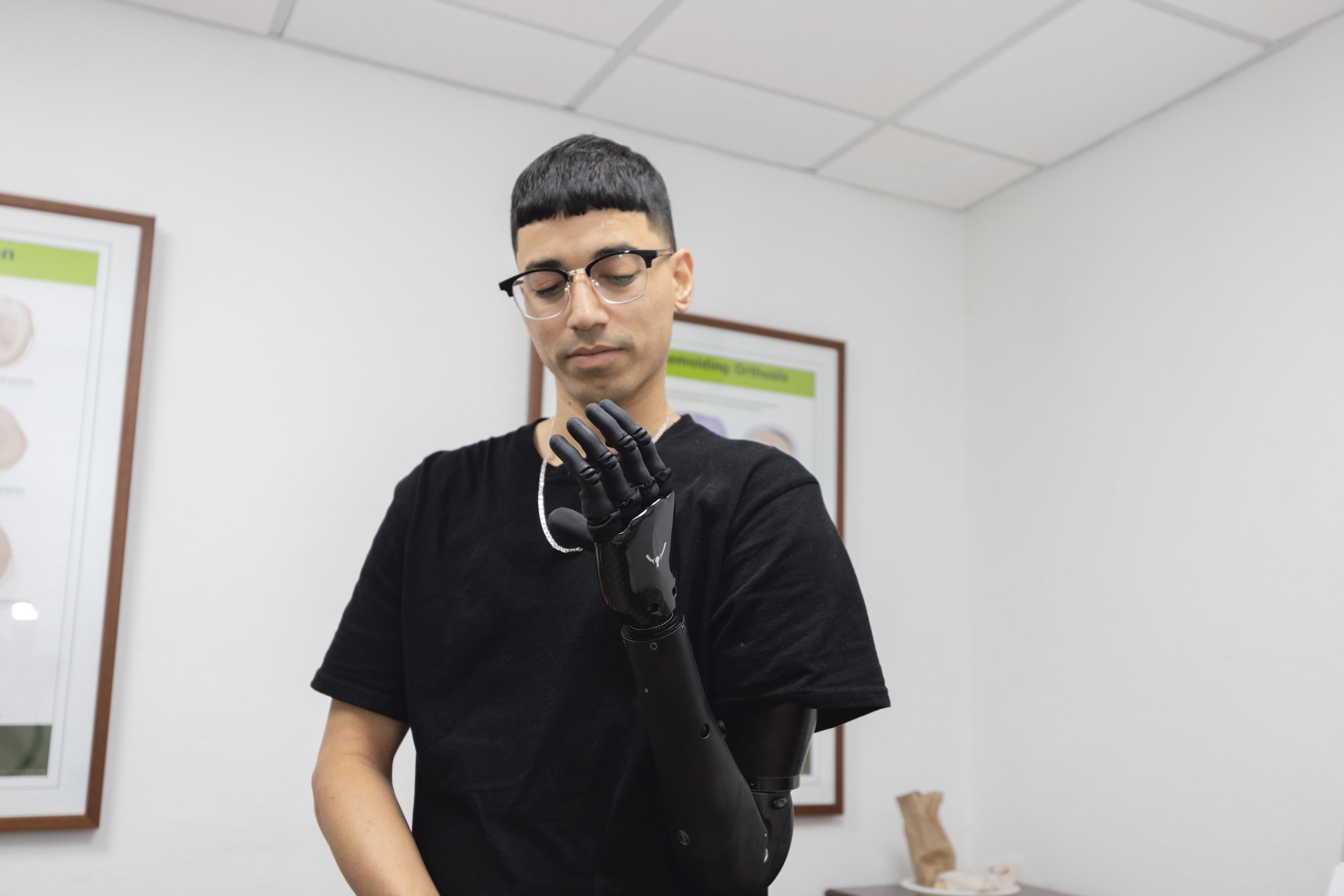 Lesionado Damián Seda Alemán durante la entrega de su prótesis mioeléctrica.