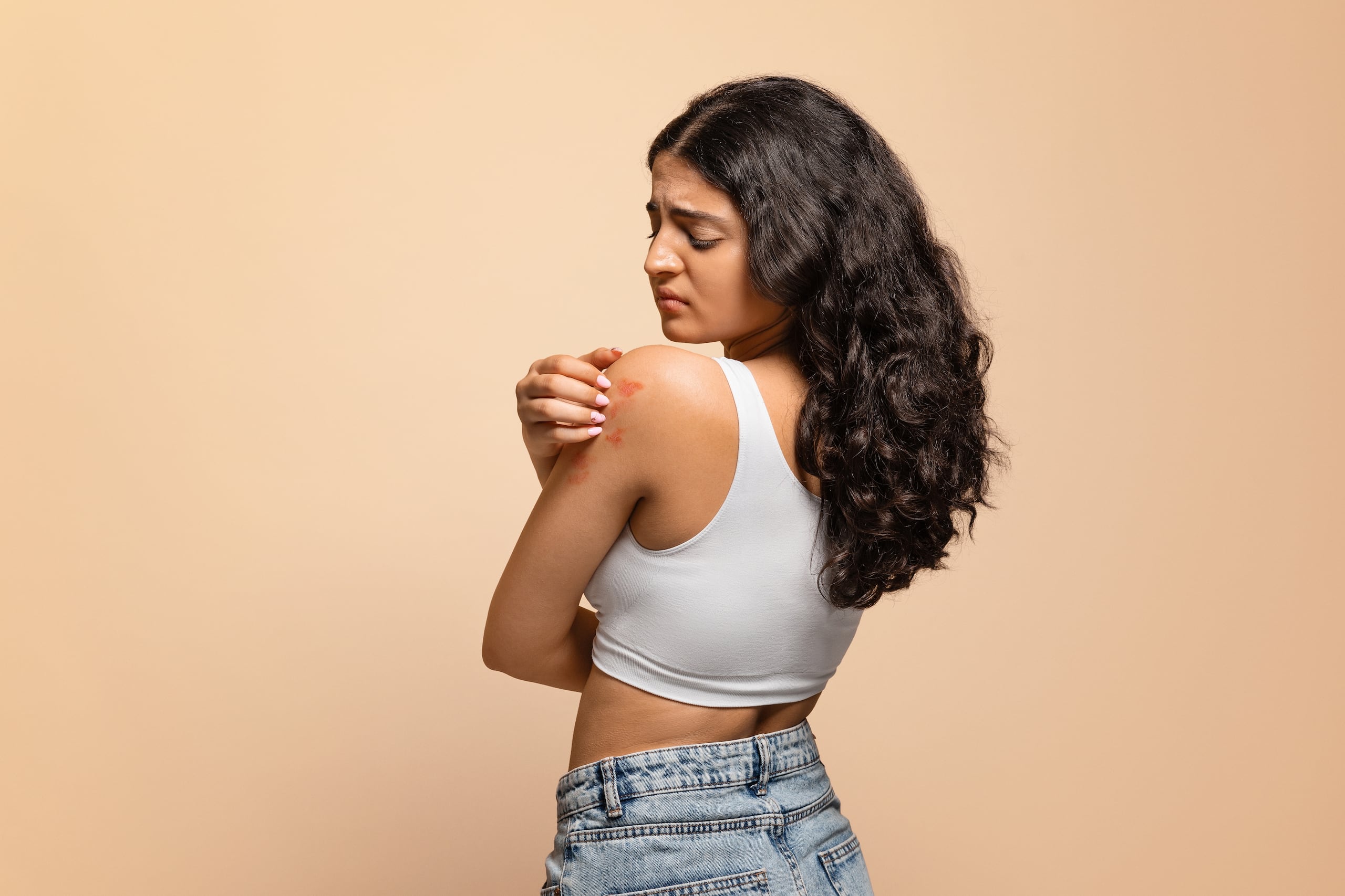 En la dermatitis de contacto, los alérgenos activan directamente los mastocitos, lo que provoca una pequeña inflamación y el picor.