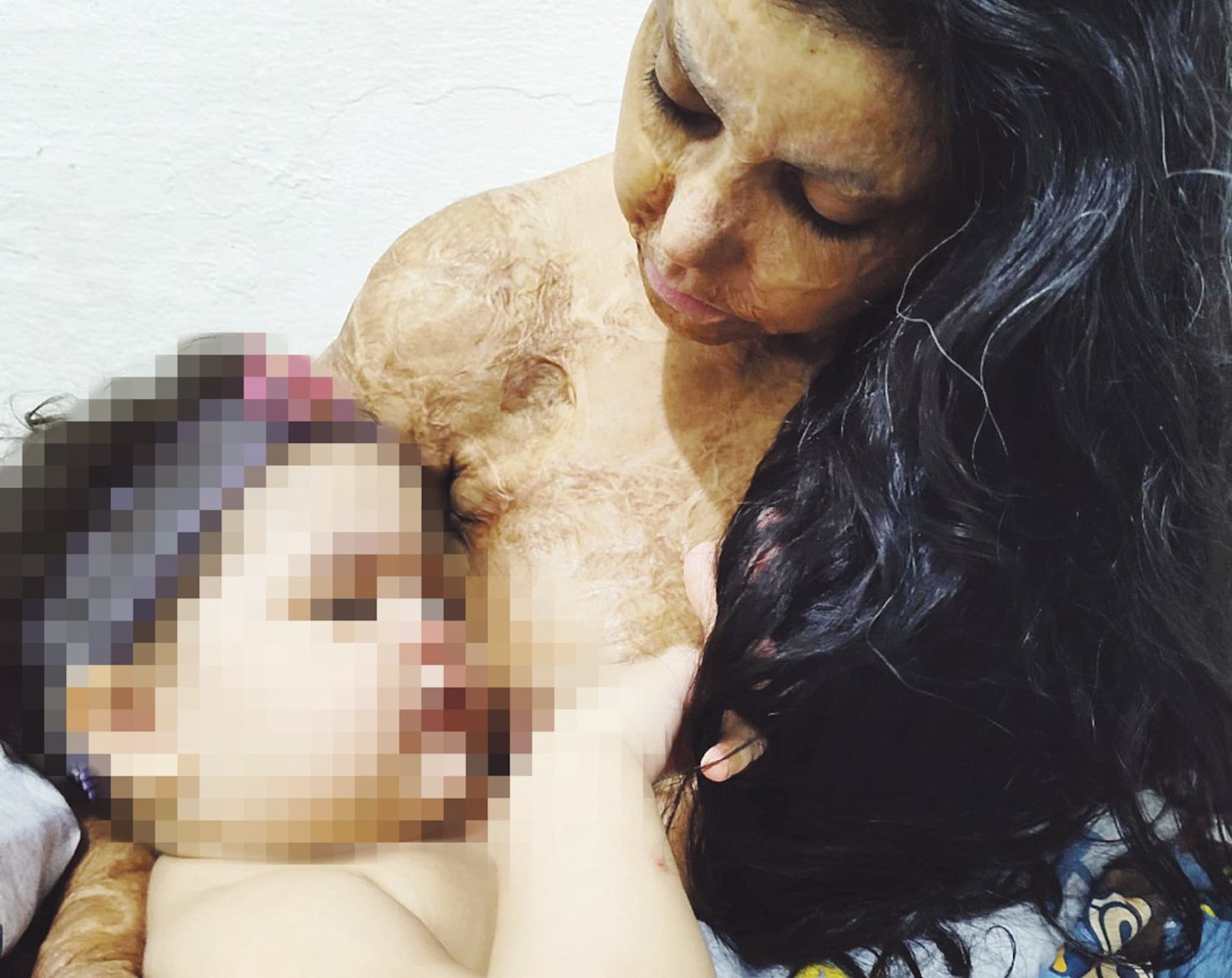 Zaleimy Santos Santos, con apenas dos añitos, enfrenta un cuadro de asma crónica y solo con leche materna ha reflejado una mejoría sustancial en su salud.