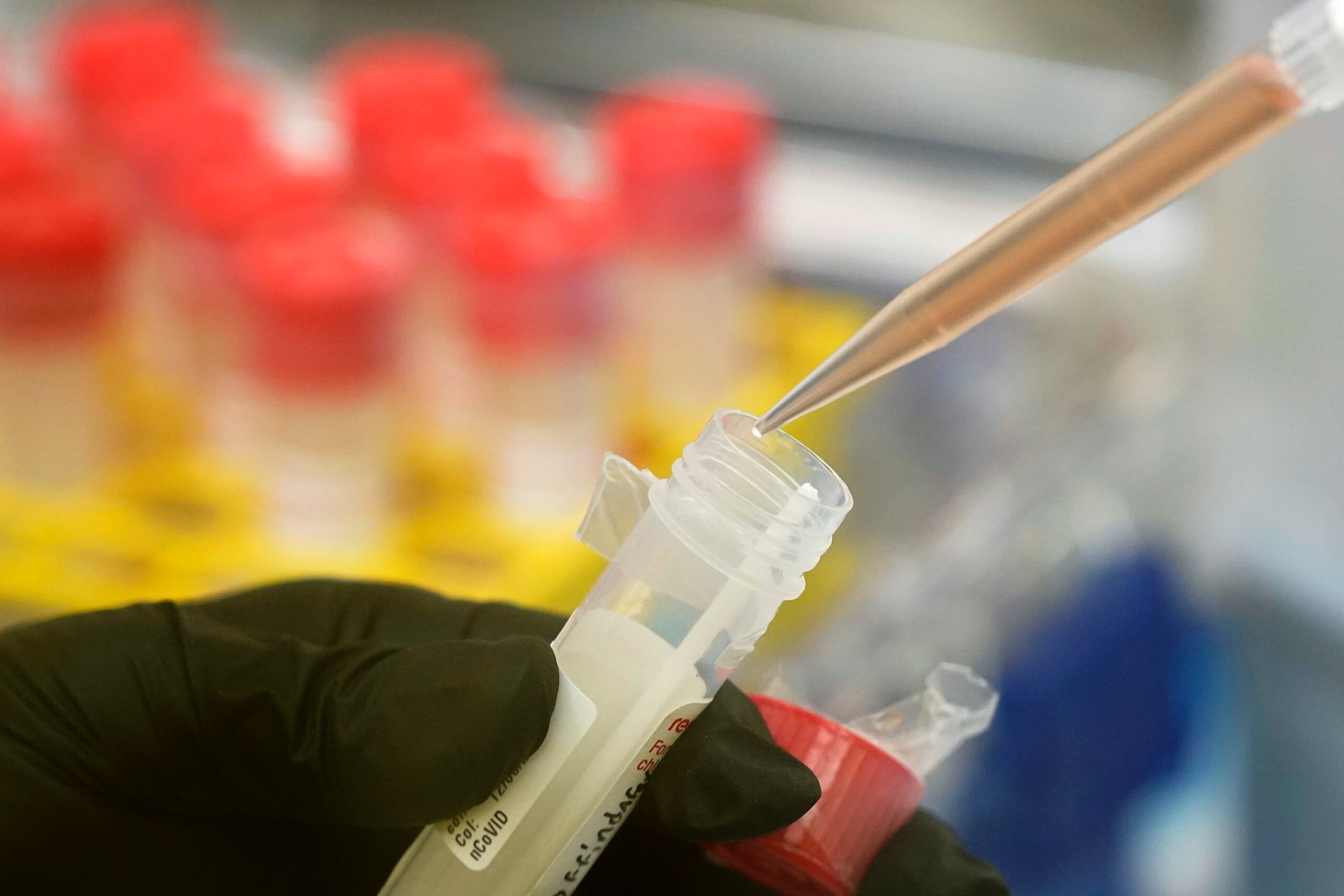 La infectóloga recomendó en caso de tener sospecha, hacerse una prueba de detección de Covid.