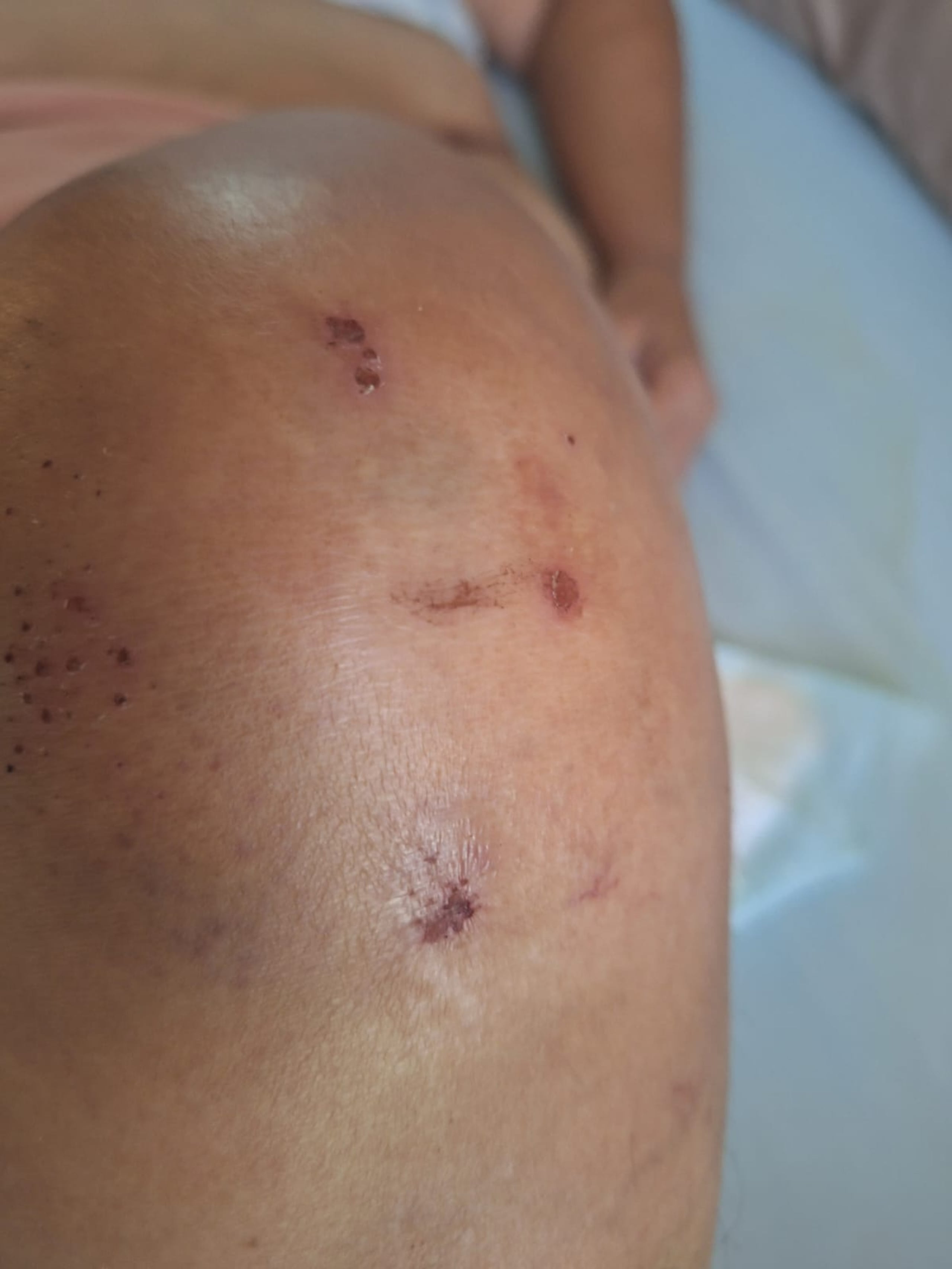 Senado investigará alegada muerte por maltrato en hospital psiquiátrico