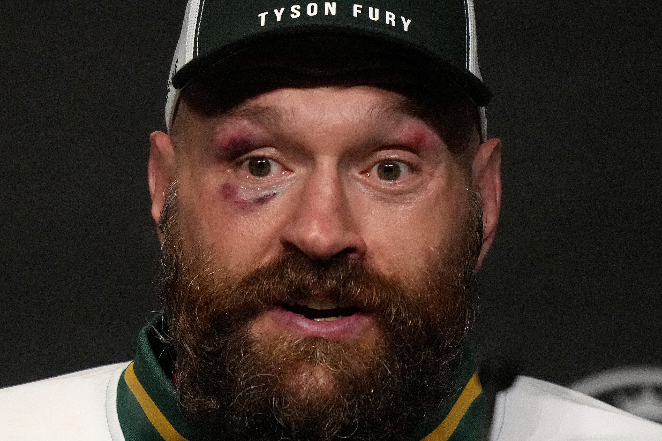 Tyson Fury durante una rueda de prensa tras perder ante Oleksandr Usyk en una pelea por el campeonato mundial de los pesos pesados el 22 de diciembre de 2024, en Riad, Arabia Saudí.