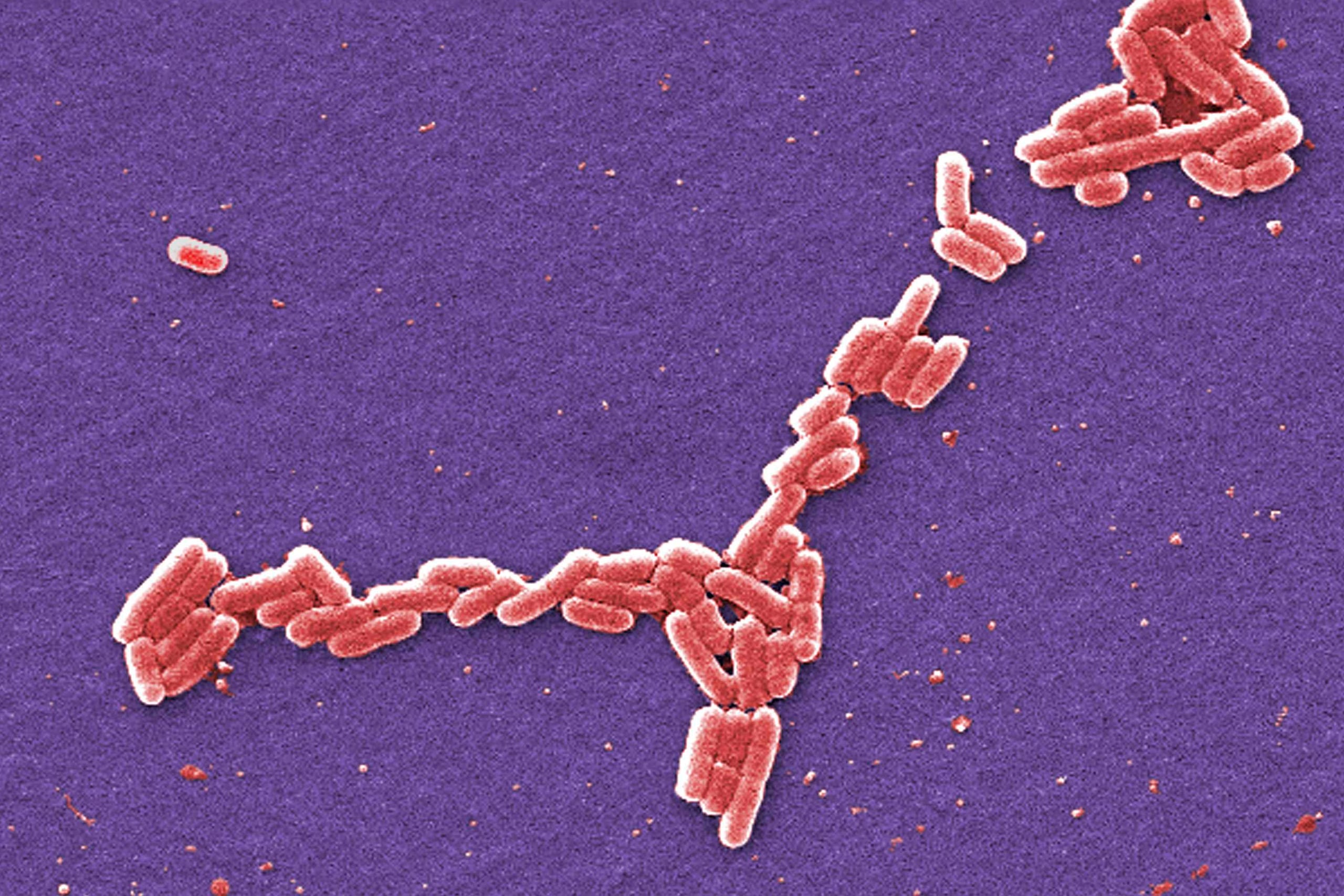 Esta imagen de 2006 extraída de un microscopio, proporcionada por los Centros para el Control y la Prevención de Enfermedades de Estados Unidos, muestra una bacteria E. Coli, la cual produce una toxina que puede causar enfermedades. (AP)