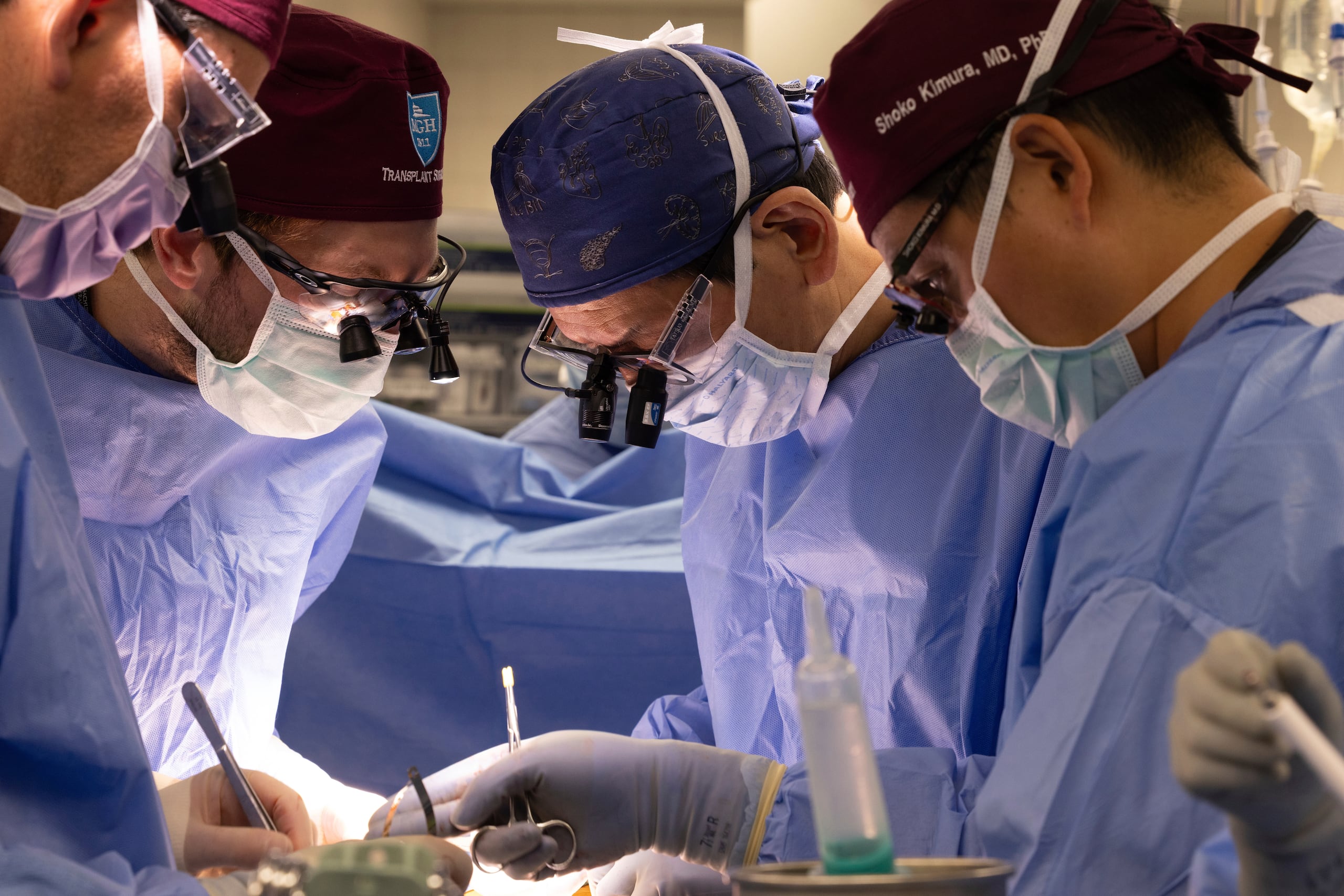 En esta foto proporcionada por Mass General Brigham, de izquierda a derecha, los cirujanos Dr. Nahel Elias, Dr. Alban Longchamp, Dr. Tatsuo Kawai y Dr. Shoko Kimura trasplantan un riñón de cerdo genéticamente modificado a Bill Stewart el 14 de junio de 2025 en el Massachusetts General Hospital en Boston.