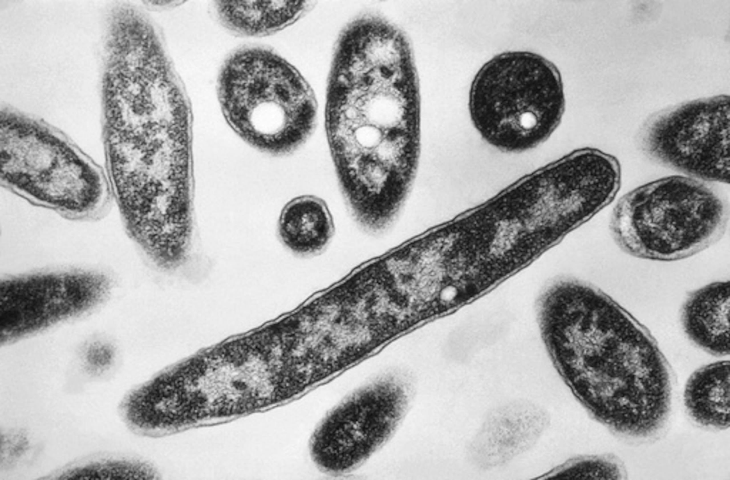 ARCHIVO - Esta imagen tomada con microscopio electrónico en 1978, facilitada por los Centros para el Control y la Prevención de Enfermedades, muestra la bacteria Legionella pneumophila, responsable de provocar la enfermedad pulmonar conocida como «enfermedad del legionario». (Francis Chandler/CDC vía AP, archivo)