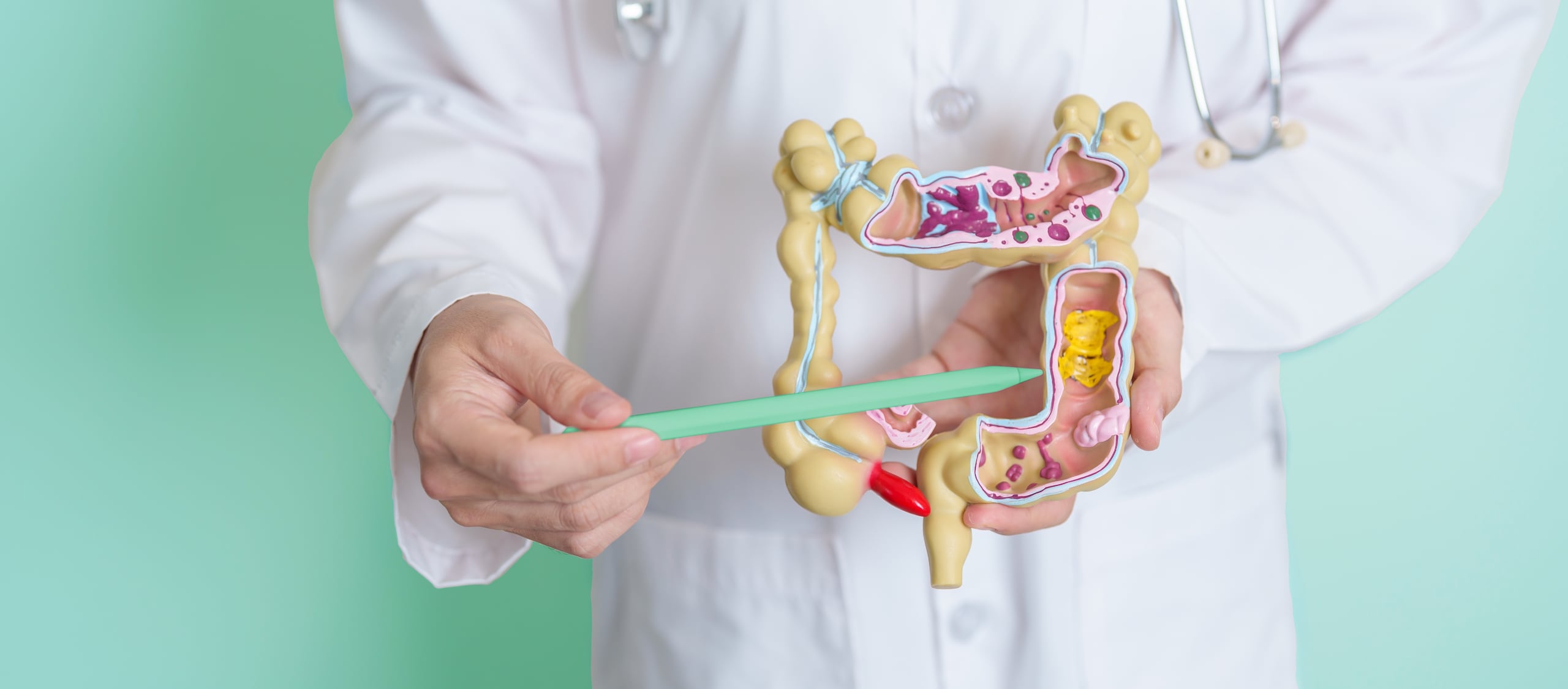 El diagnóstico temprano del cáncer de colon, a menudo, puede conducir a una cura completa.