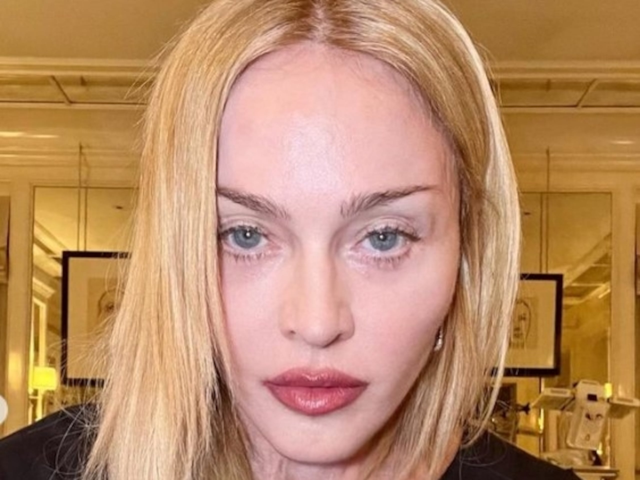 Madonna utilizó su cuenta de Instagram para comunicar que se está recuperando.