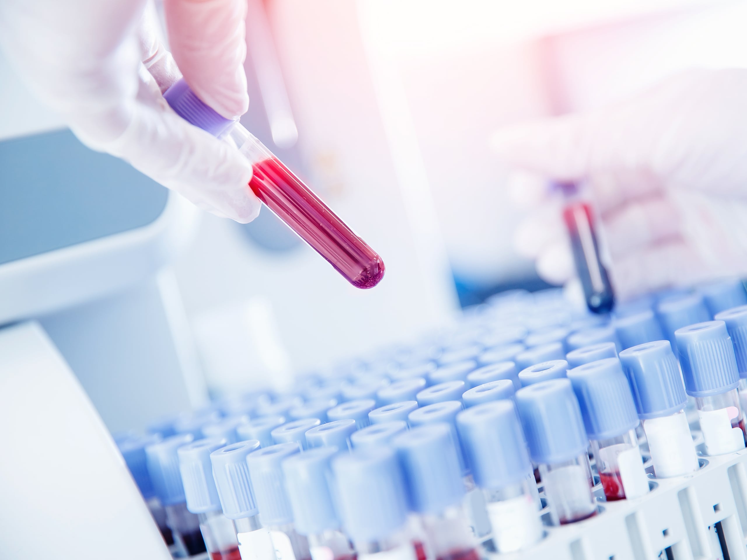 La incapacidad de las células madre de producir células sanguíneas saludables, puede provocar una disminución en los glóbulos blancos, los glóbulos rojos y las plaquetas.
