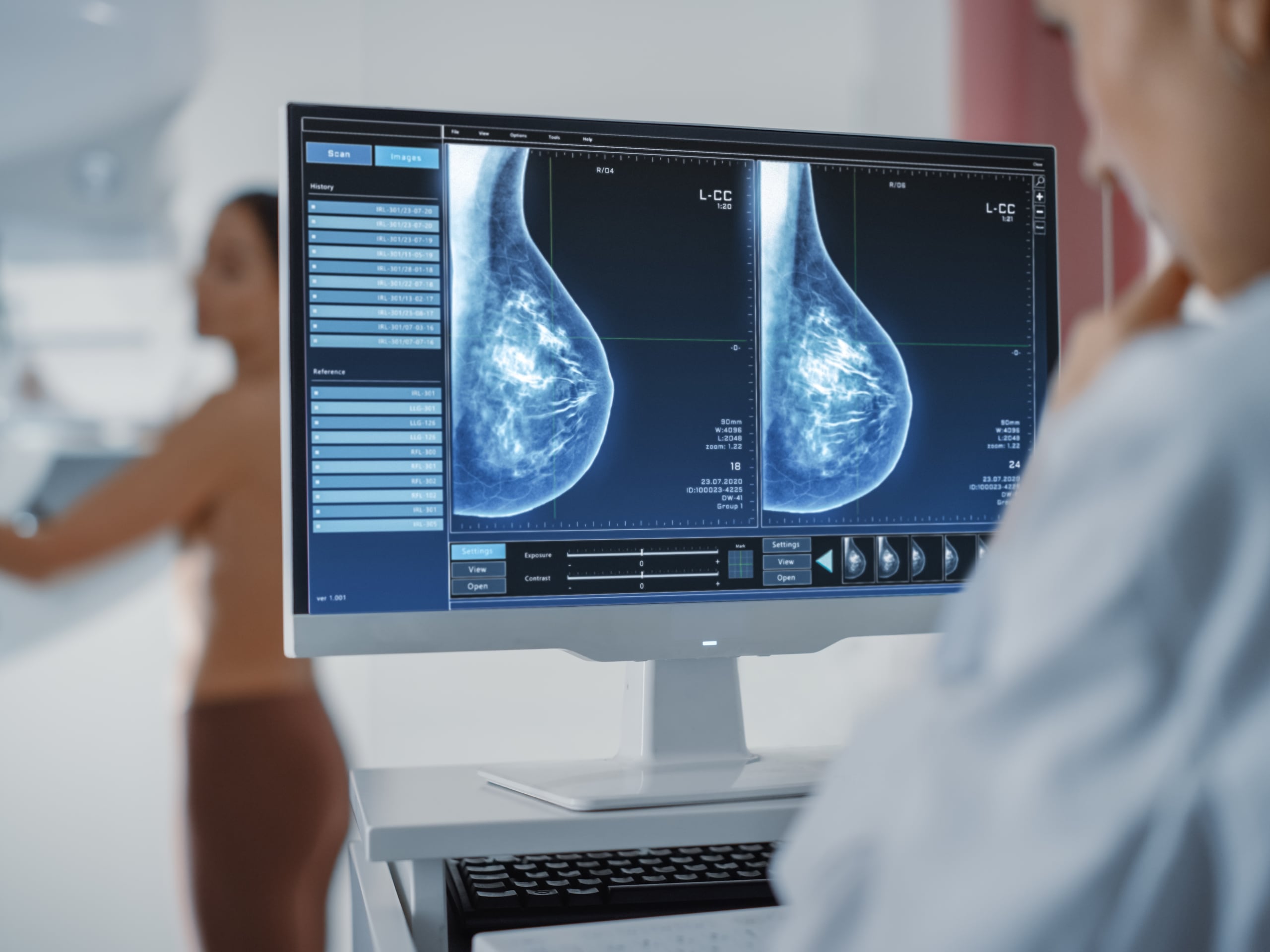 Los mecanismos de detección del cáncer de seno son diversos y dependerán de la edad del paciente, de los factores de riesgo y de los síntomas que presente.