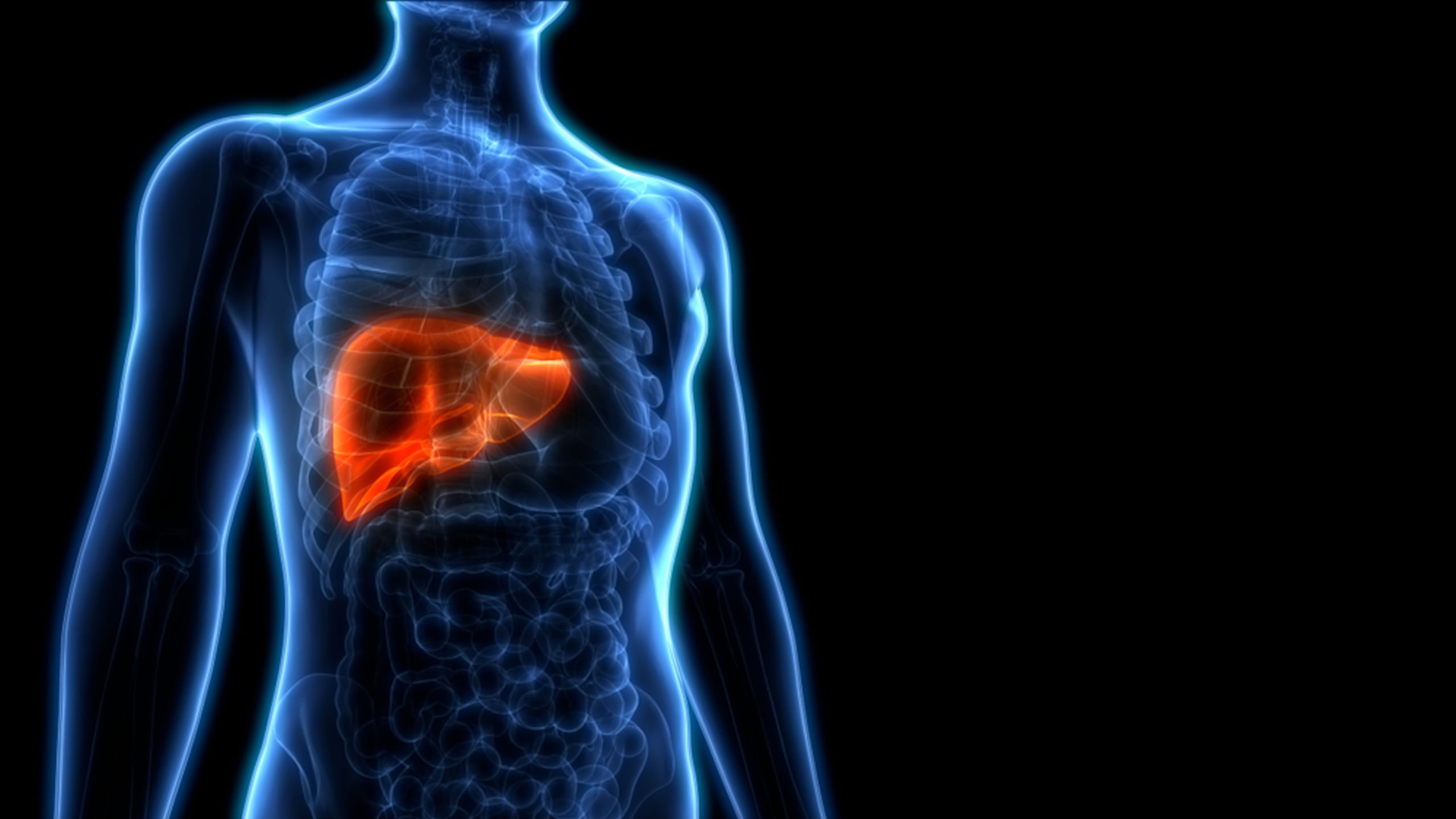 Suele ser asintomática hasta etapas avanzadas, cuando ya puede causar complicaciones como cirrosis o cáncer hepático.
