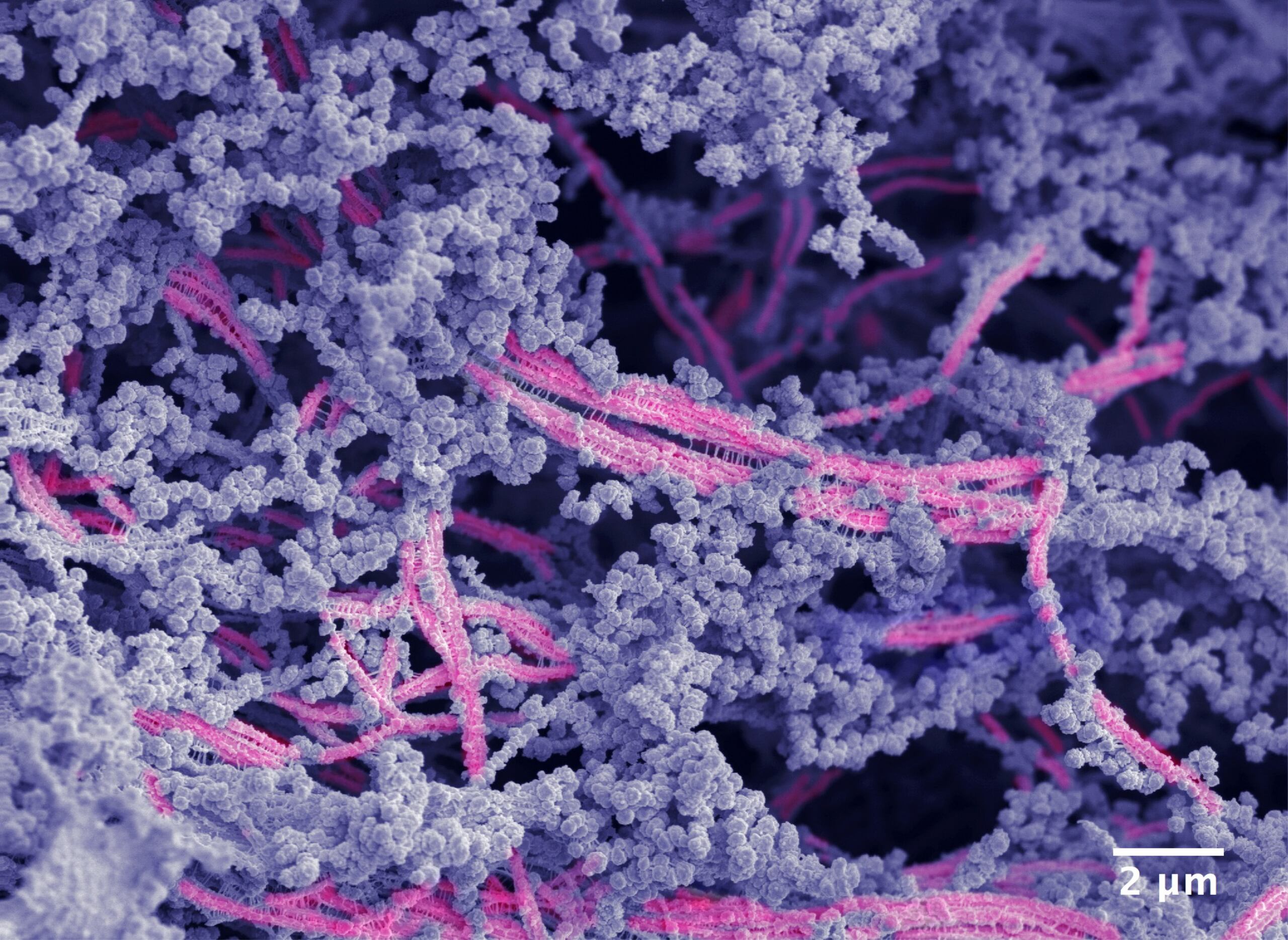 Imagen microscópica del nuevo biomaterial. Las nanofibras son de color rosa y el ácido hialurónico se muestra en violeta.
