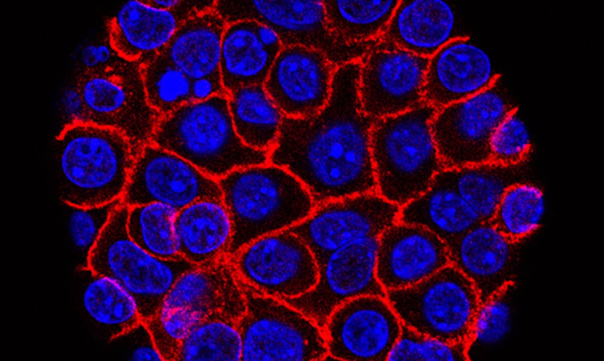 Píldora experimental promete nueva esperanza contra el cáncer de páncreas - Primera Hora