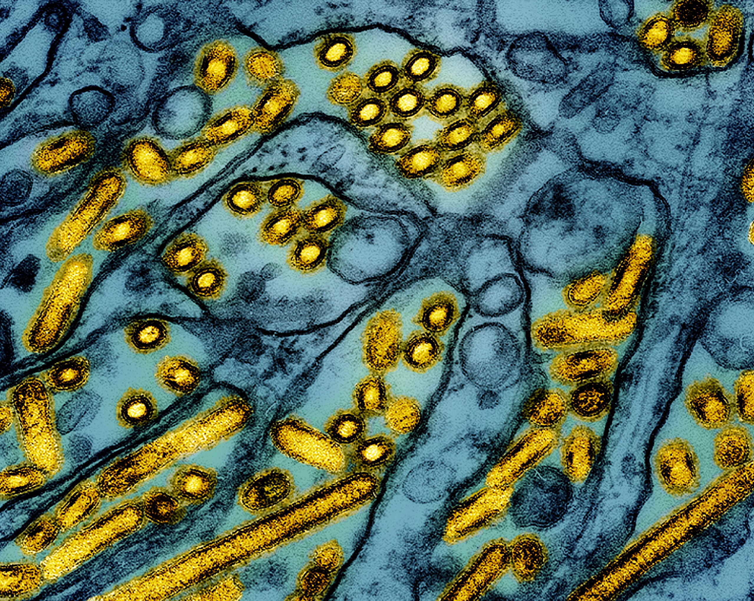 ARCHIVO - Esta imagen coloreada de microscopio electrónico publicada por el Instituto Nacional de Alergias y Enfermedades Infecciosas el 26 de marzo de 2024 muestra partículas del virus de la influenza aviar A H5N1 (amarillo), cultivadas en células epiteliales del riñón canino Madin-Darby (MDCK) (azul). (CDC/NIAID vía AP, Archivo)