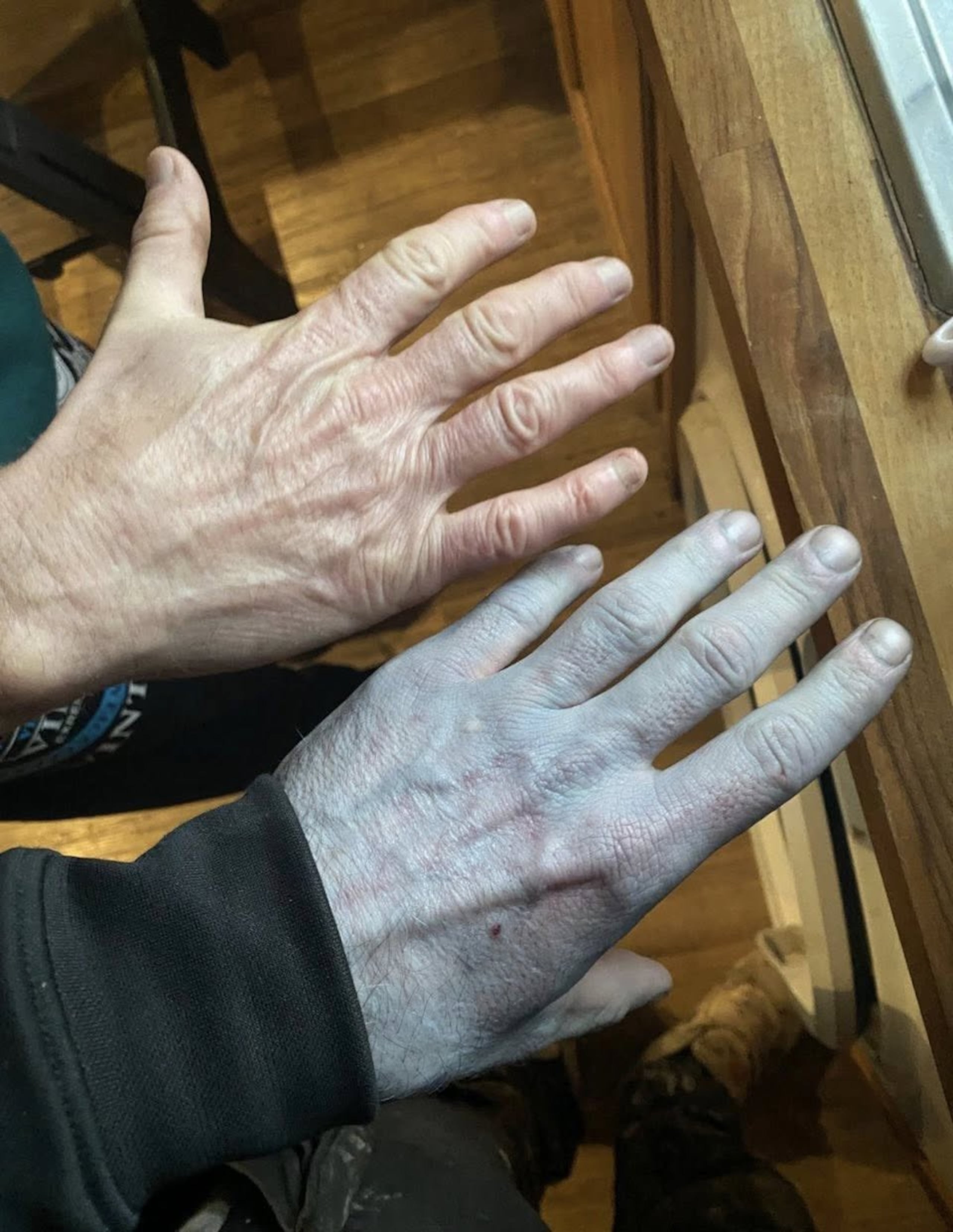 El hombre pensó que algo grave le sucedía.